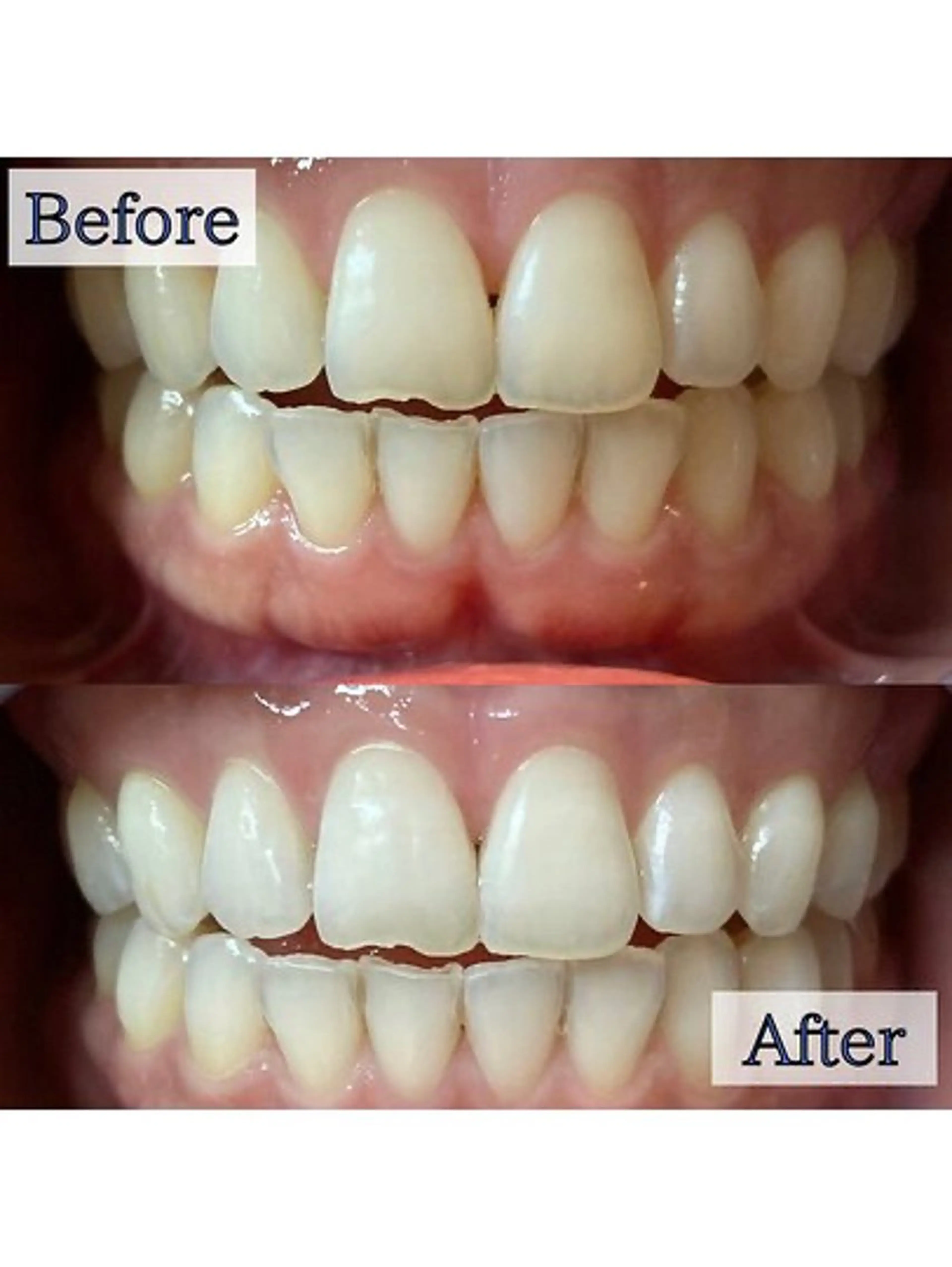 エステ リラク LBSホワイトニング 🌐 上野店公式のエステ・リラクイメージ