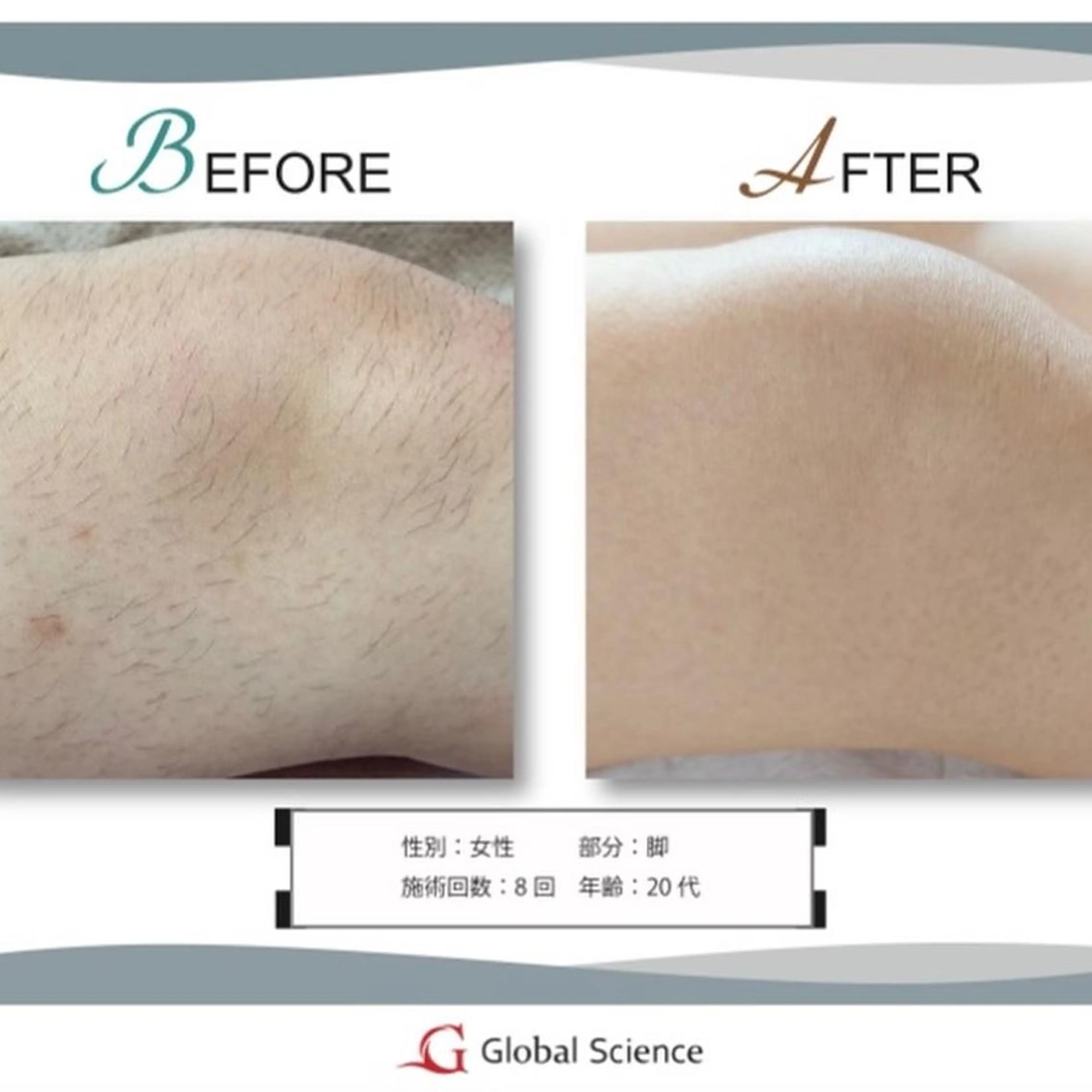 melia 岡山駅前店のエステ・リラクイメージ