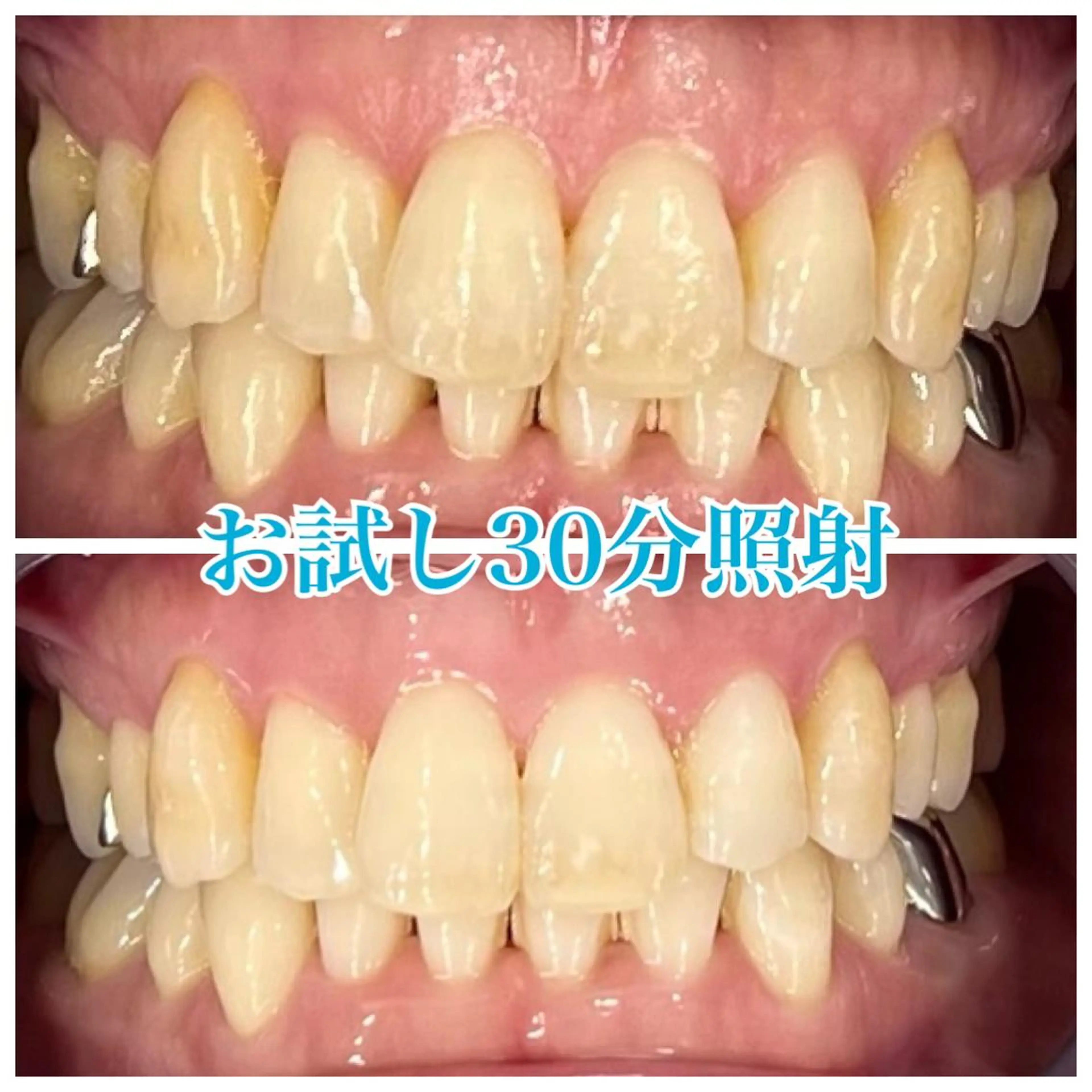 ホワイトニング🦷 ネイル💅LEAのその他イメージ