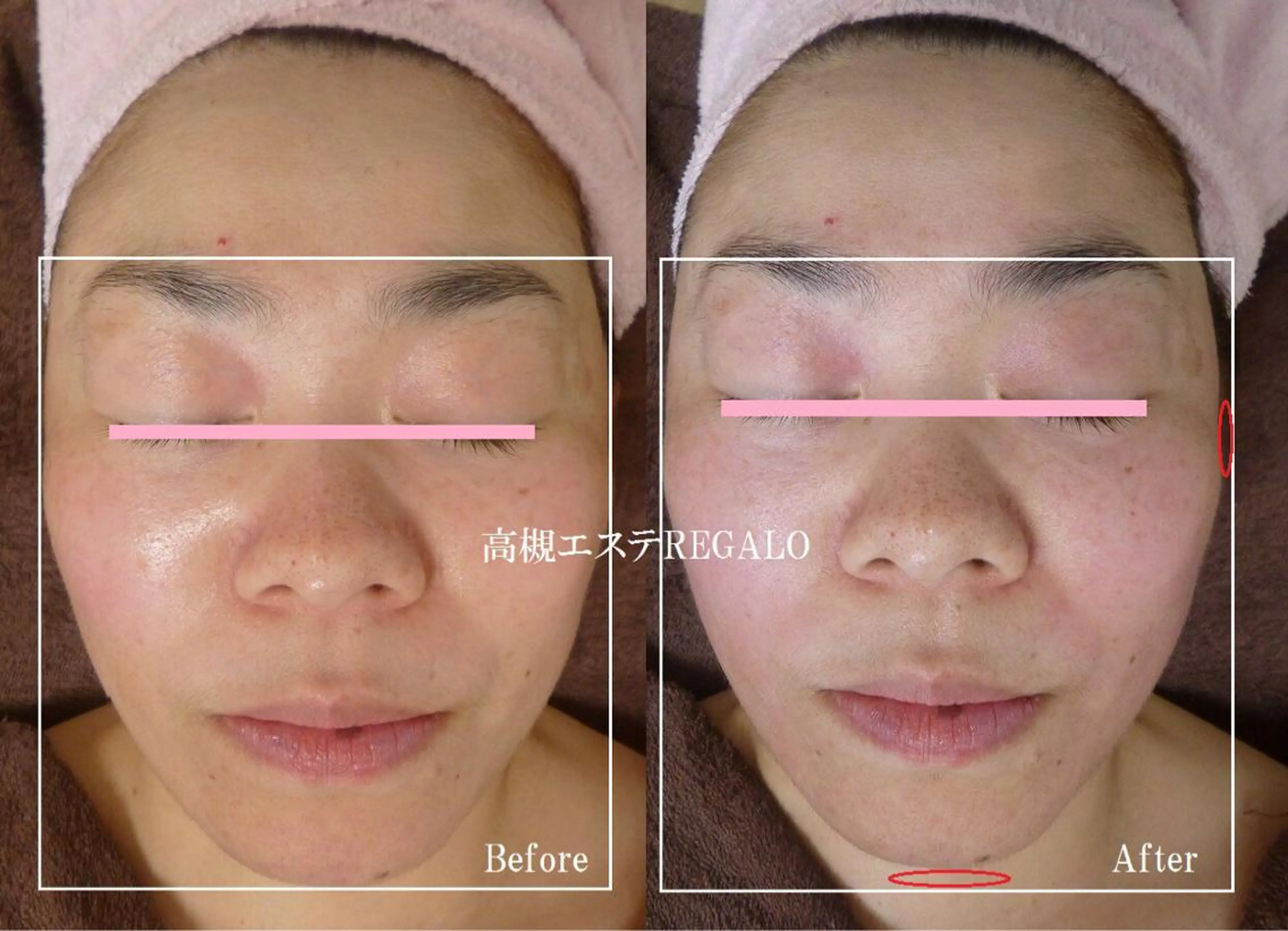 エステ 矢野 さやかのエステ・リラクイメージ