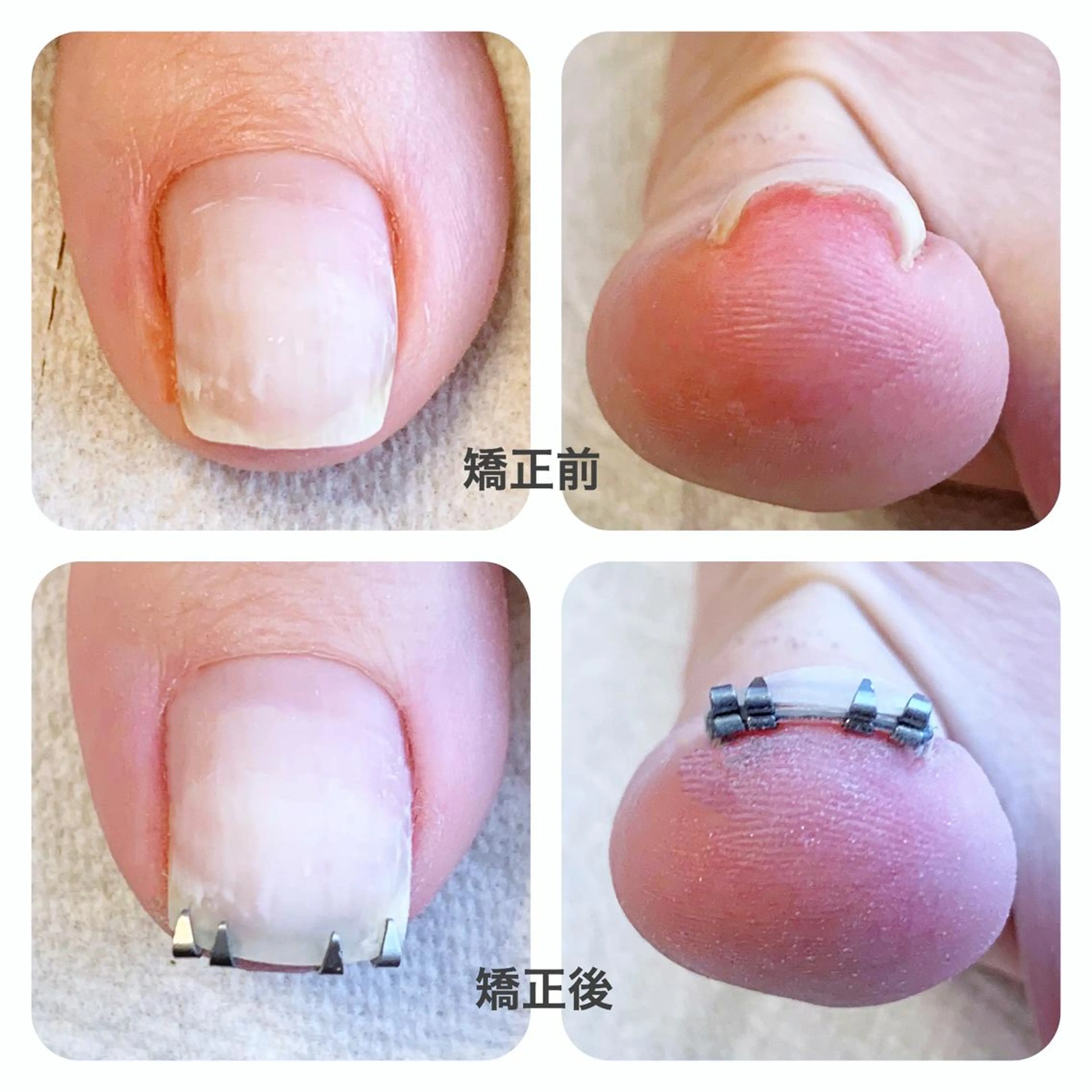 ネイル MII*NAIL／ 美フォルムsalonのネイルデザイン