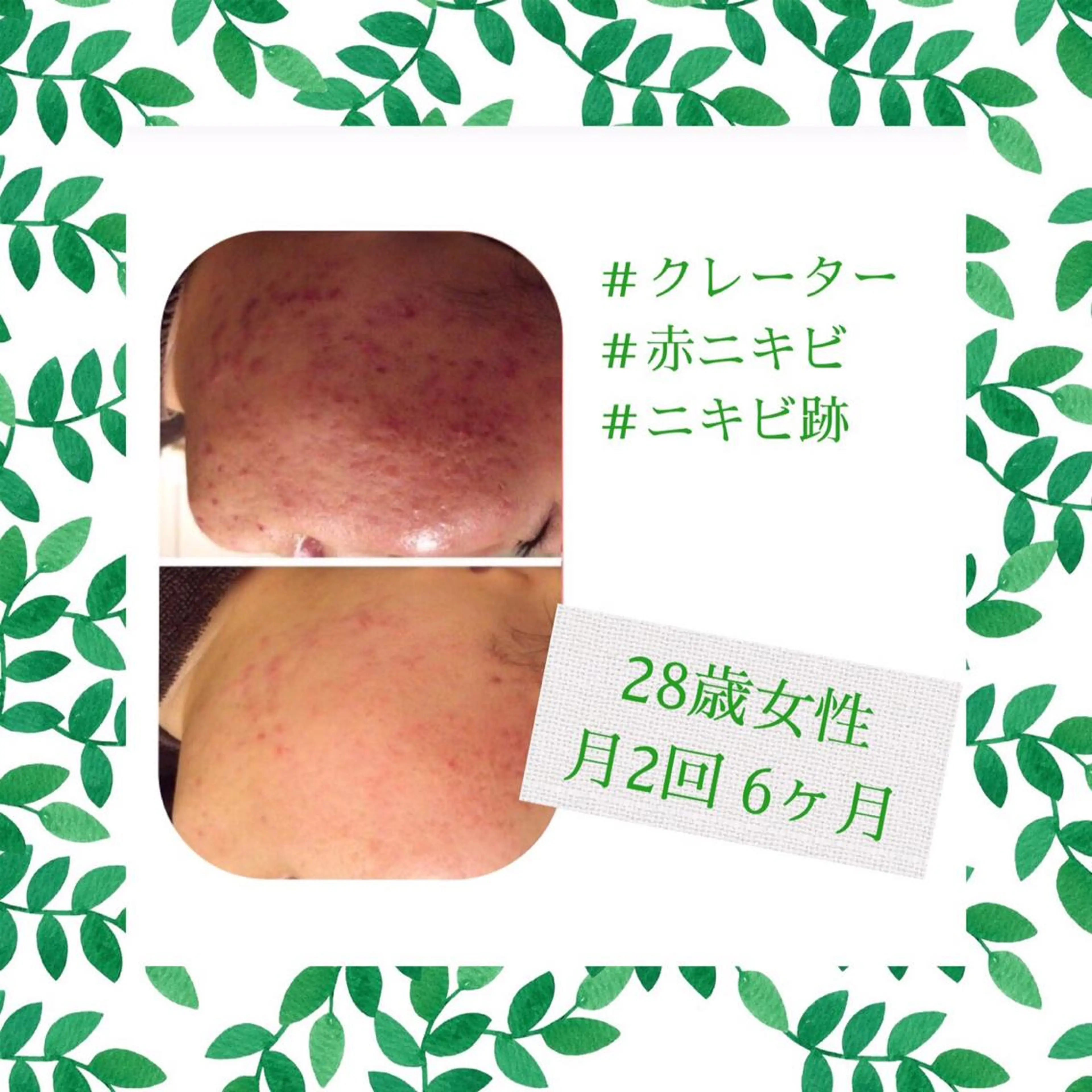 ミディアム カラー パーマ ヘアアレンジ メンズ キッズ ネイル マツエク・マツパ ニキビ・肌質改善専門 ♡人生が変わるサロンのエステ・リラクイメージ