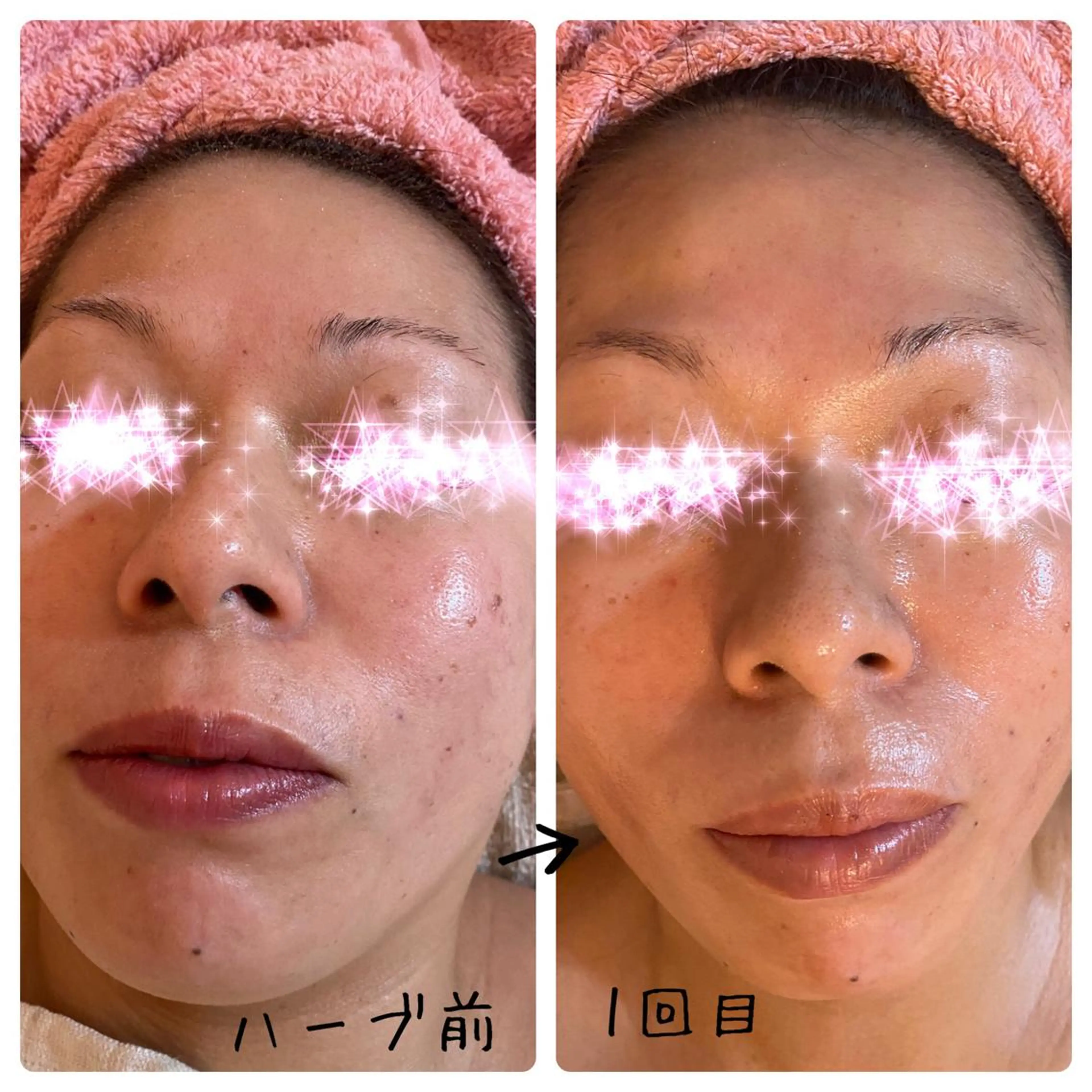 fairyrose organicエステのエステ・リラクイメージ