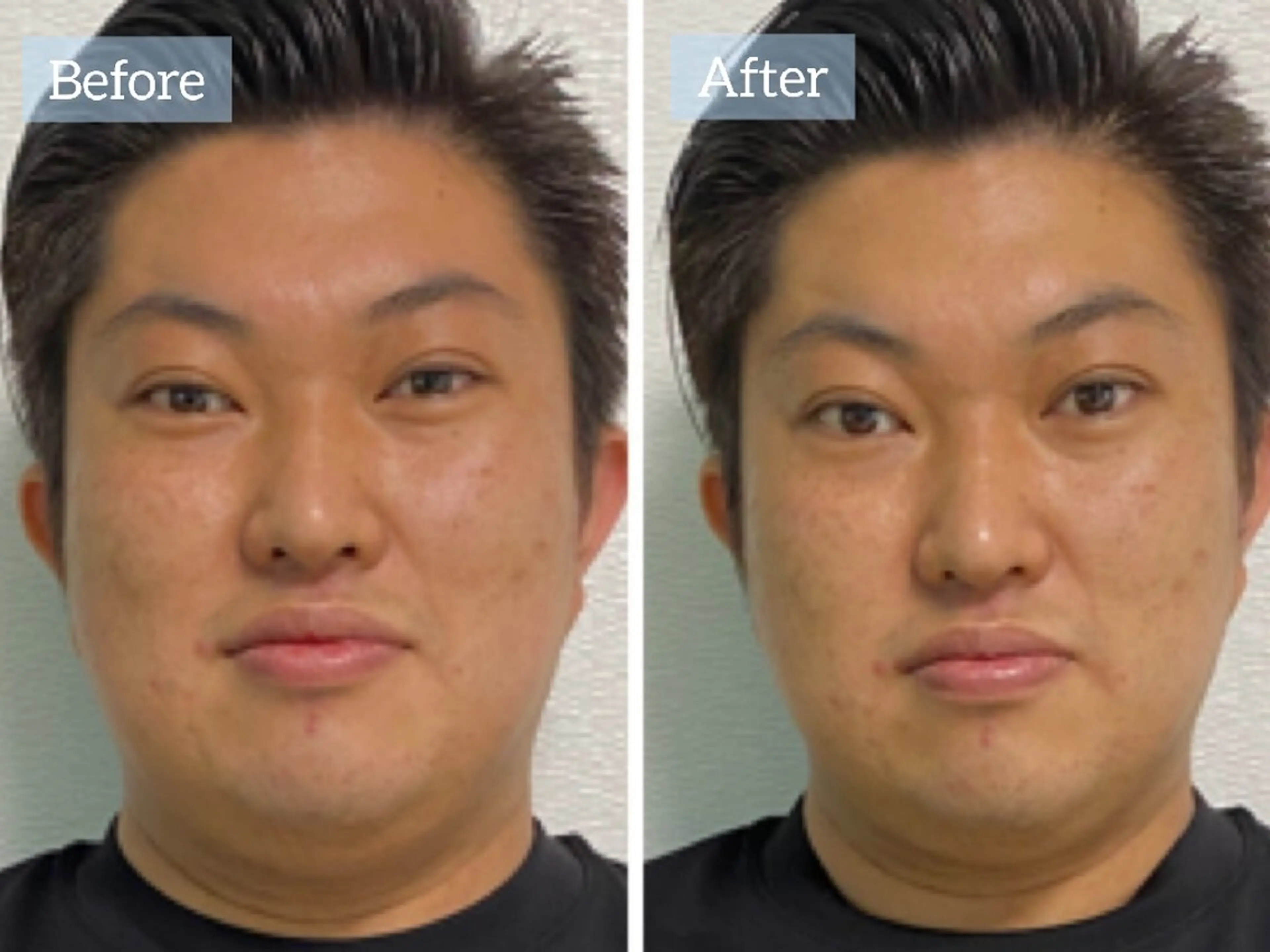 肌質改善専門店 Re.terna田辺のエステ・リラクイメージ