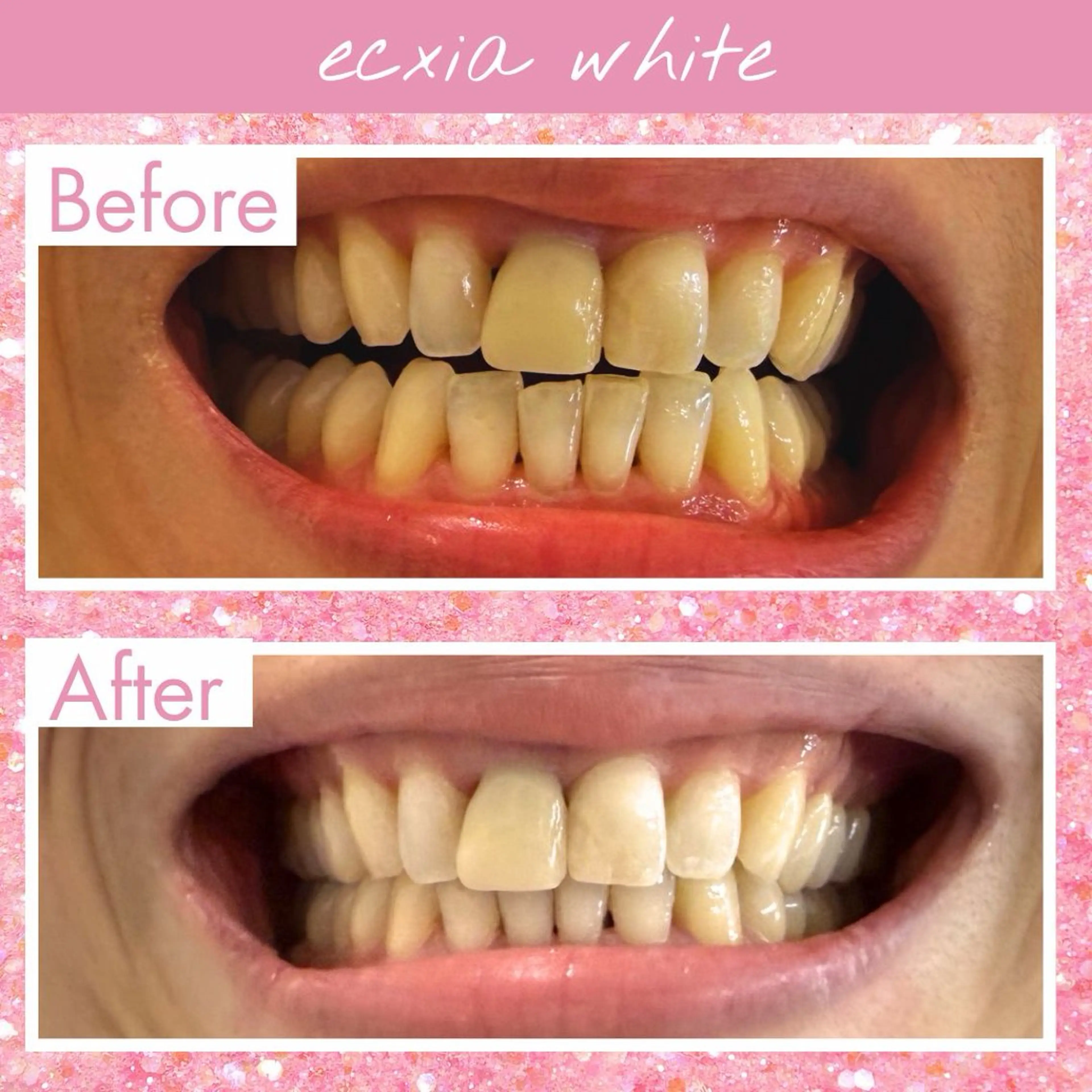 セルフホワイトニング エクシア町田店のその他イメージ