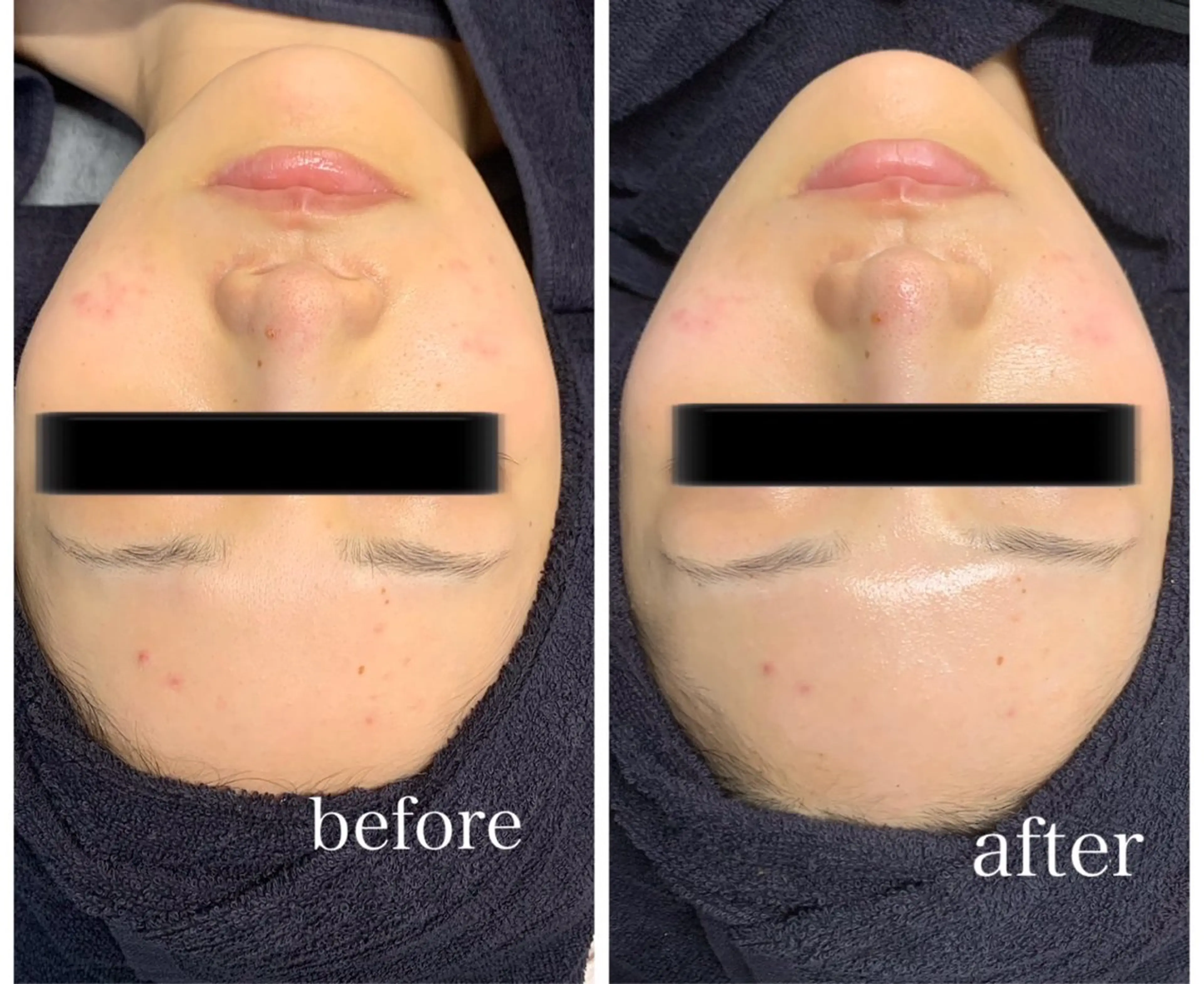 Genesis Plus大津京店のネイルデザイン