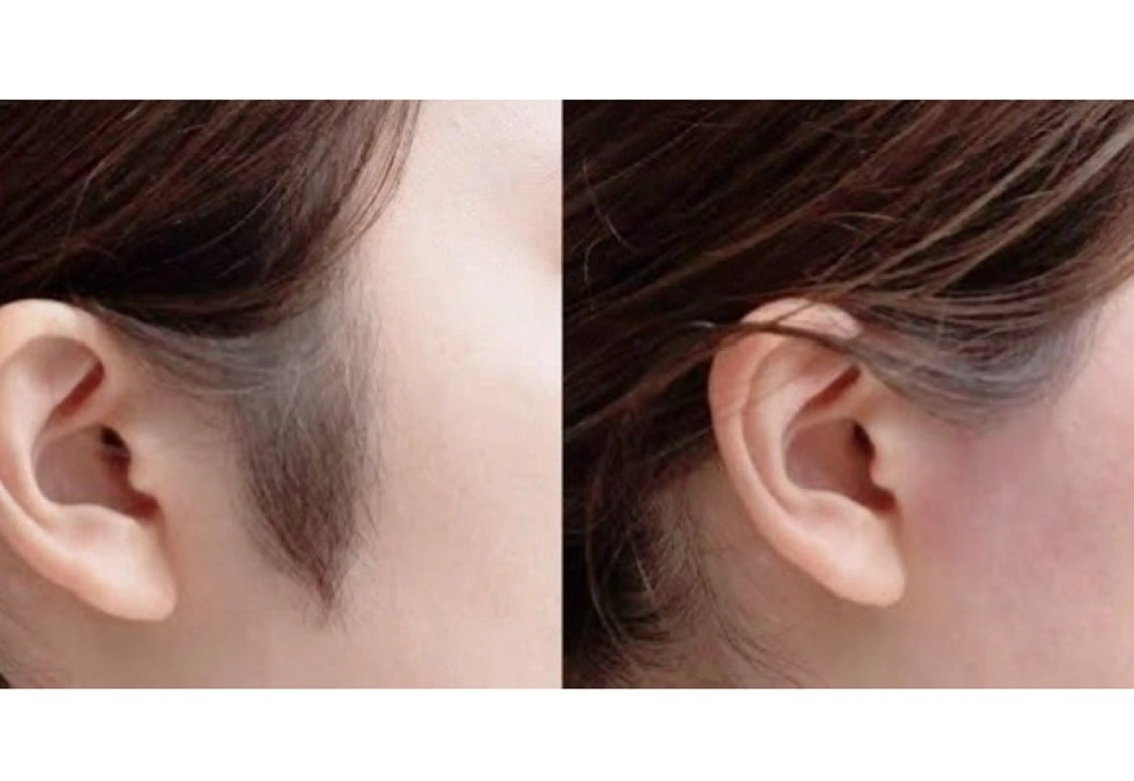 🎀💜マツパ➕もみあげWax脱毛¥5000✨美容液コーティング付き✨💜🎀の写真