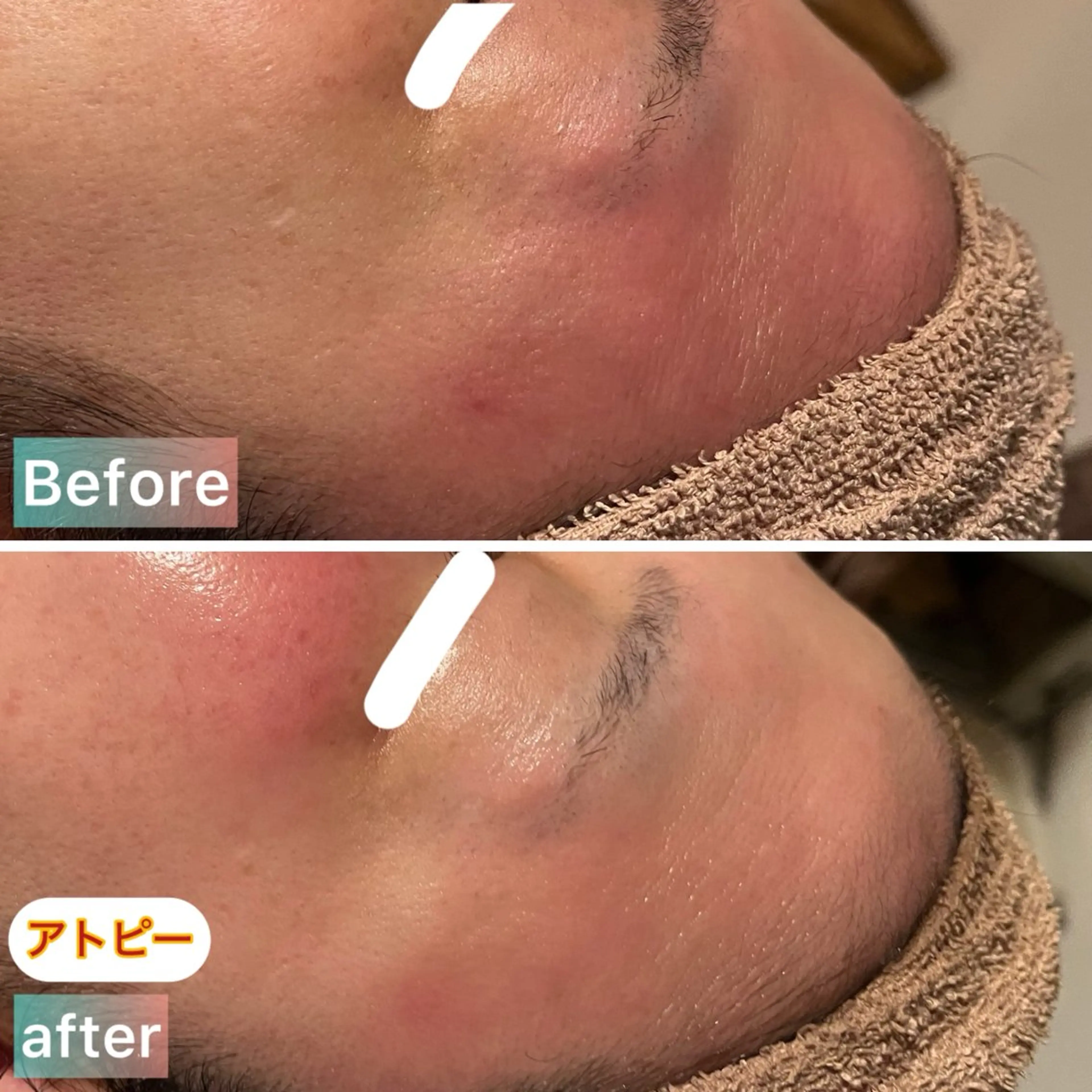 エステ LaBeIIevie ラベルヴィのマツエク・マツパデザイン