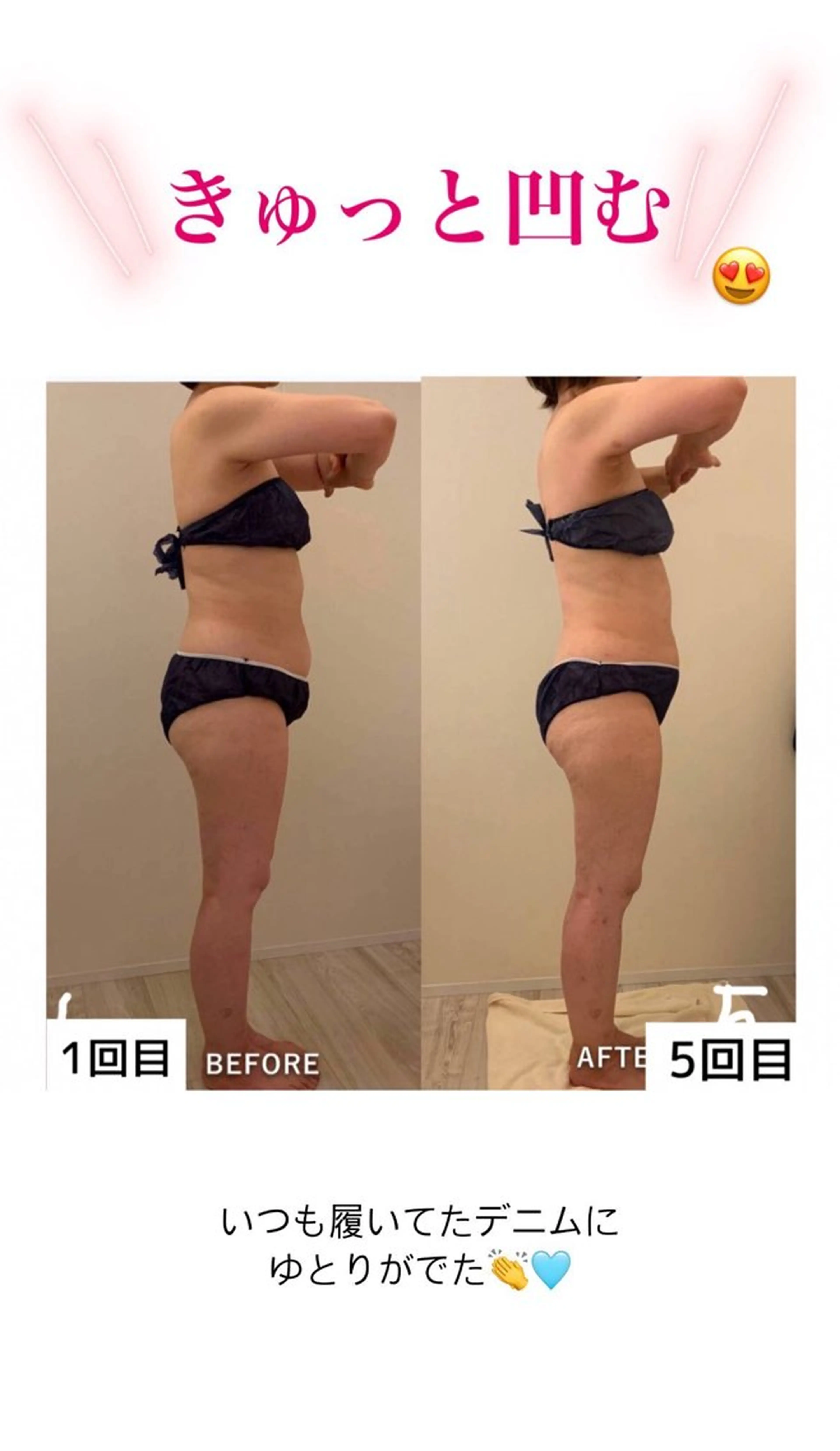 産後ダイエット−9㎏ Pourvous結衣のエステ・リラクイメージ