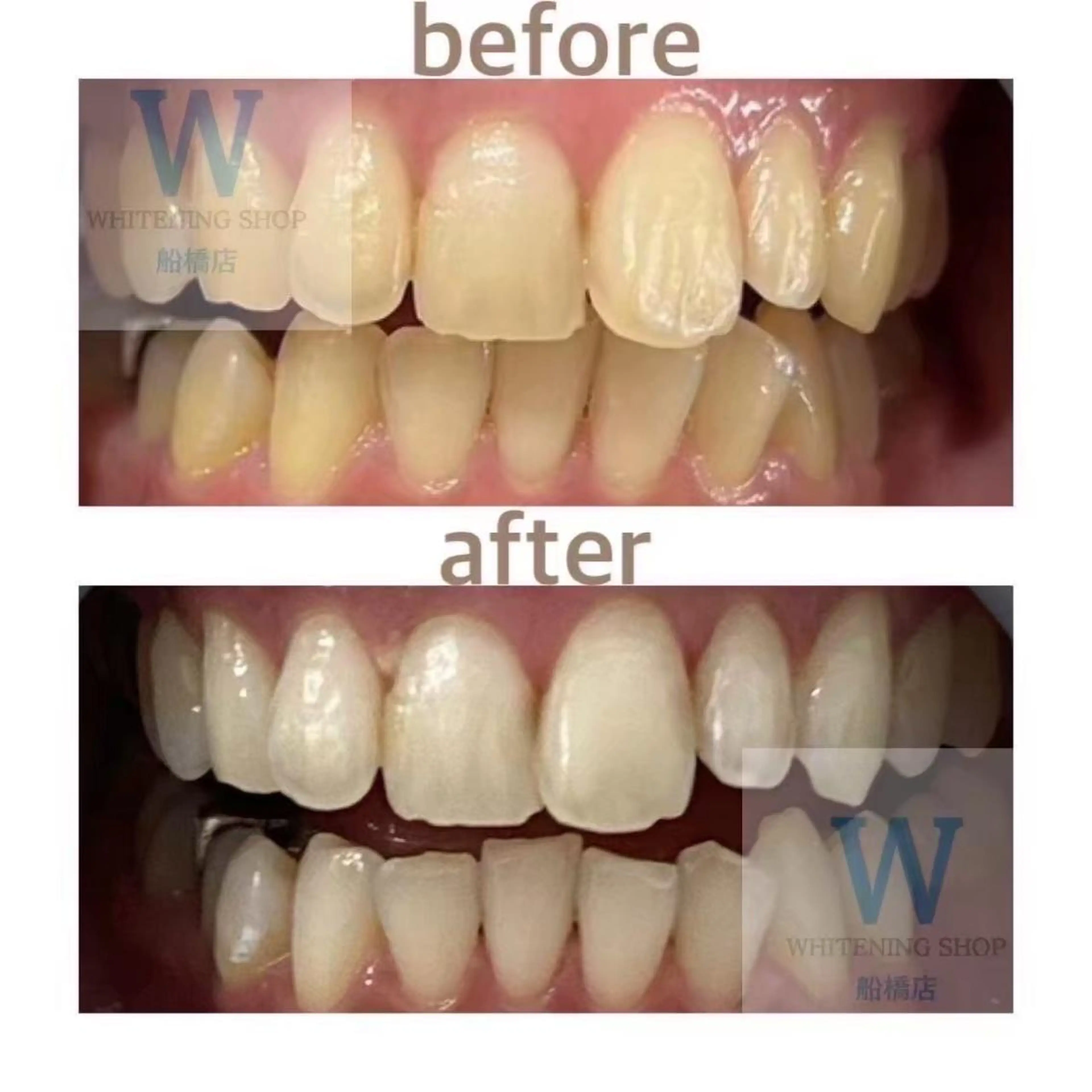 ホワイトニング ショップ船橋店🦷のエステ・リラクイメージ