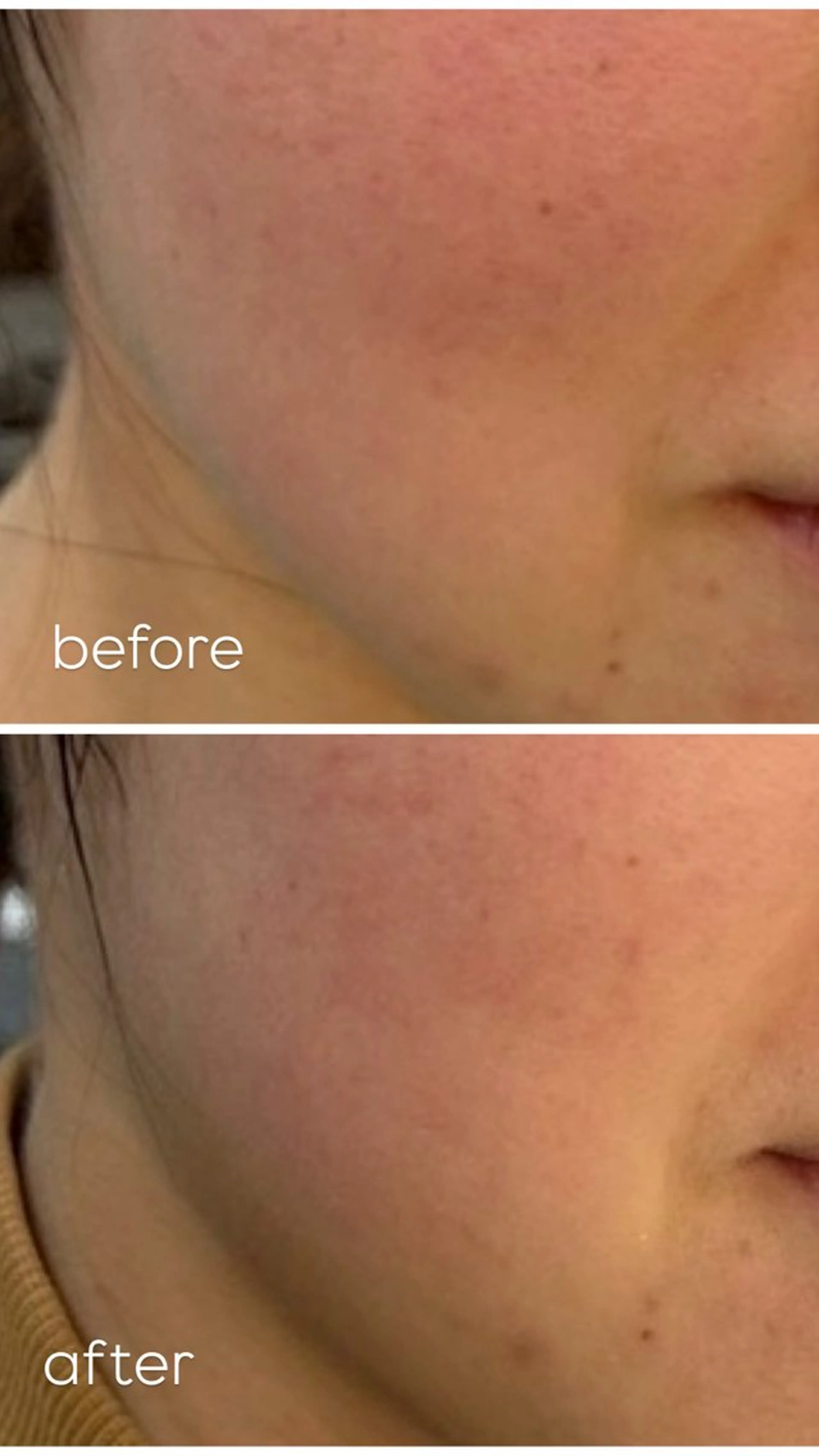 デアイム神戸東所属・先中 茜音のエステ・リラクイメージ