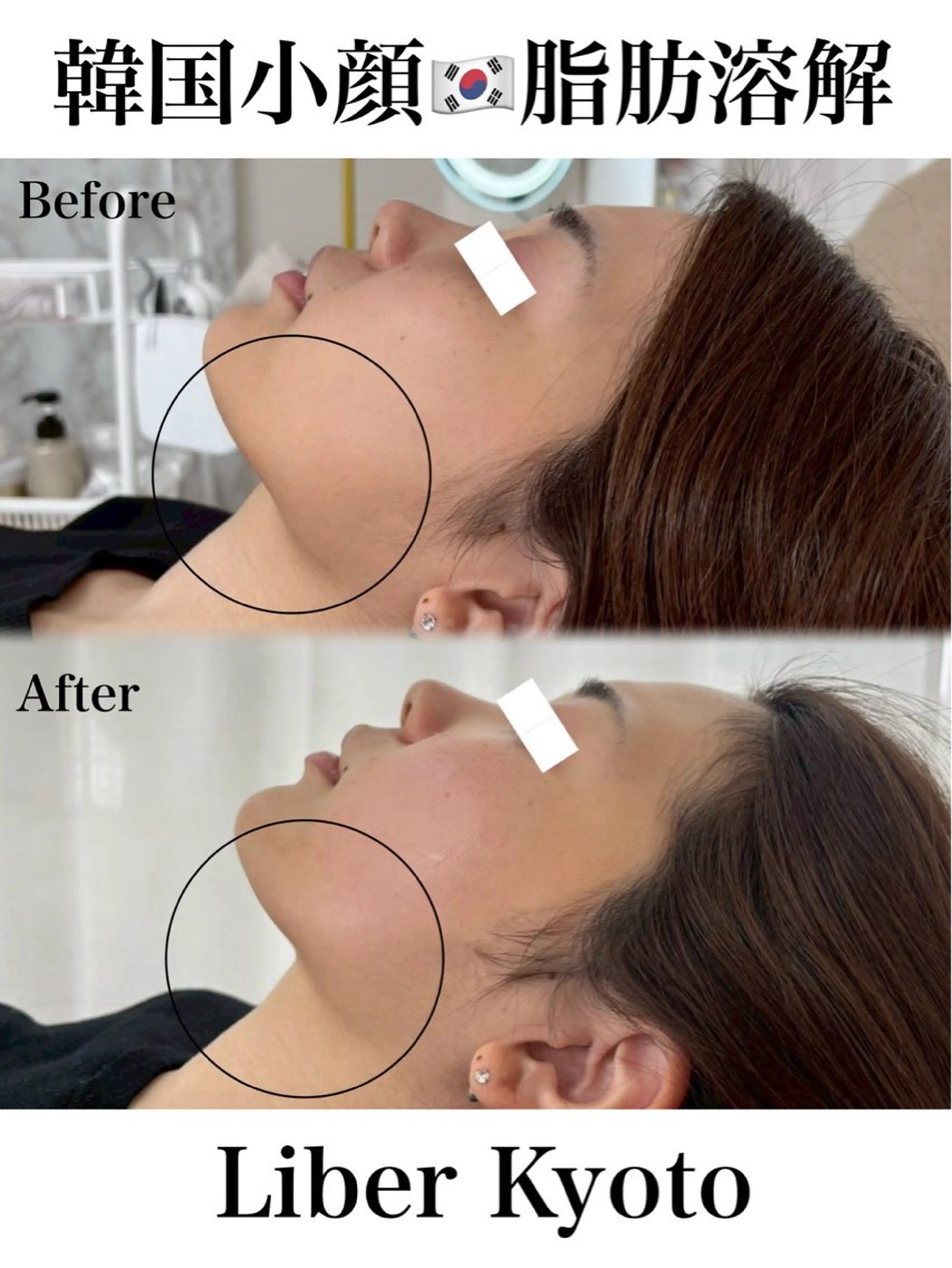 エステ Liber【リベル】 AYAKAのエステ・リラクイメージ