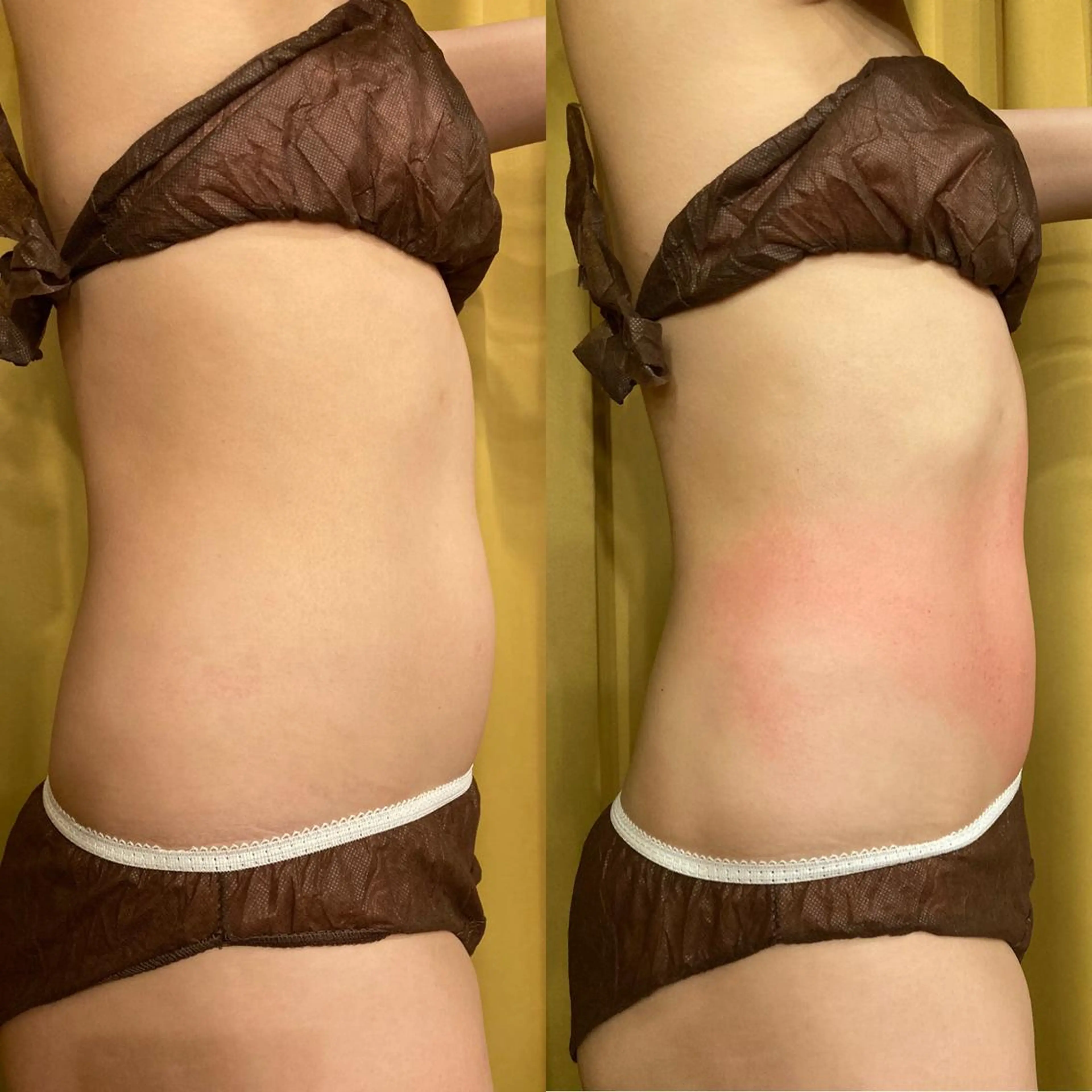 その他 小顔やたるみに特化 💚野瀬可蓮のその他イメージ