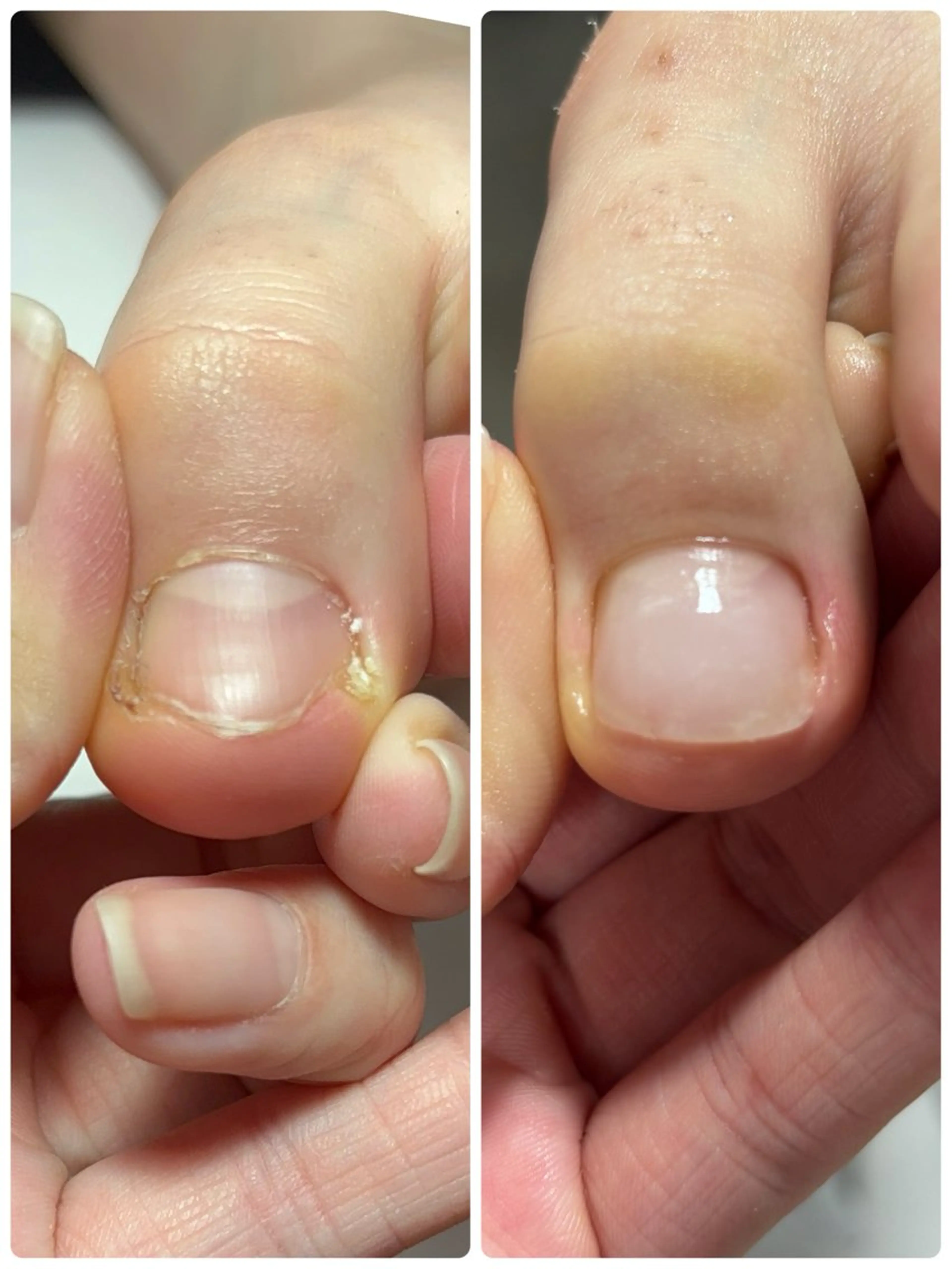 ネイル Alo.nail アロ•ネイルのネイルデザイン