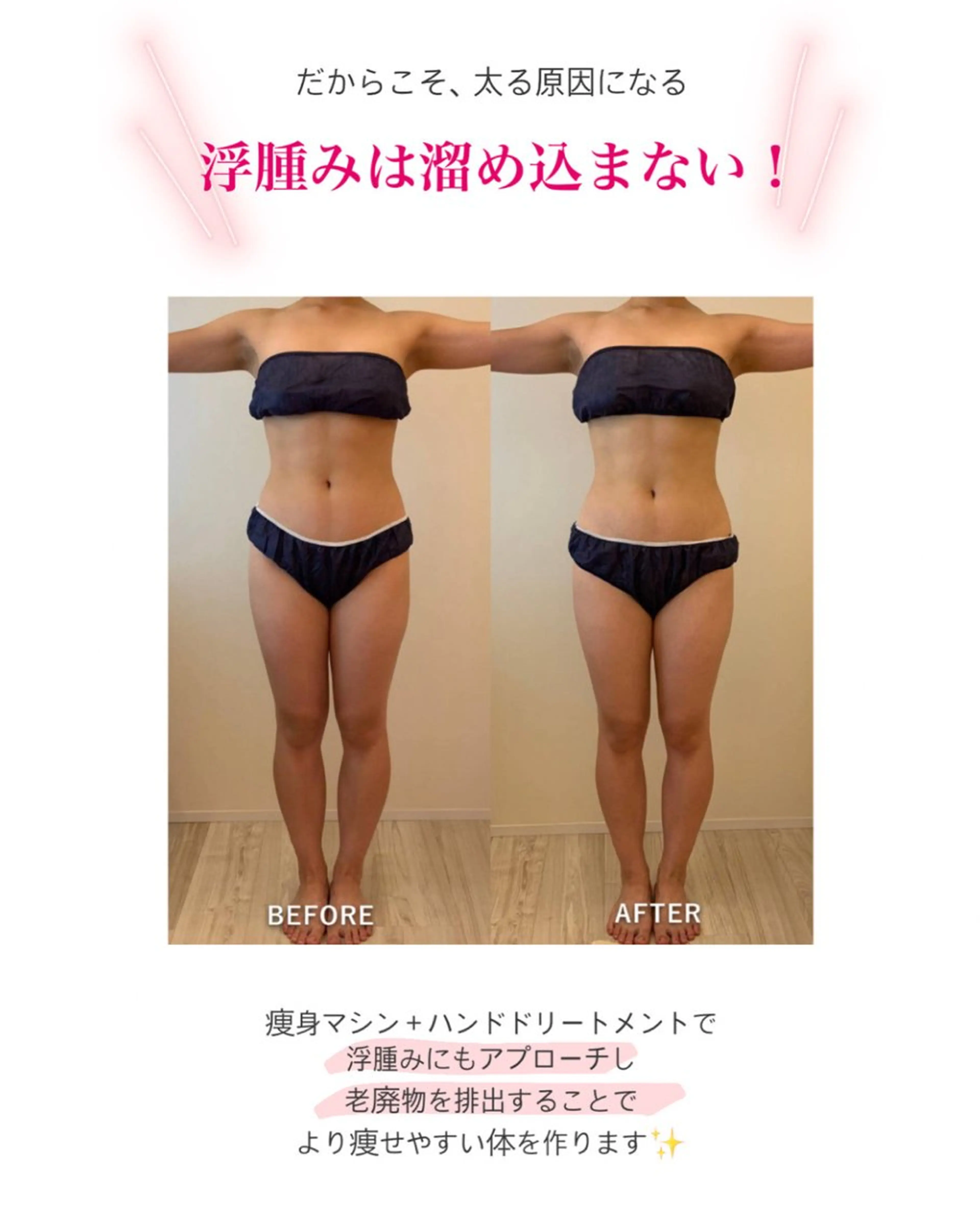 産後ダイエット−9㎏ Pourvous結衣のエステ・リラクイメージ