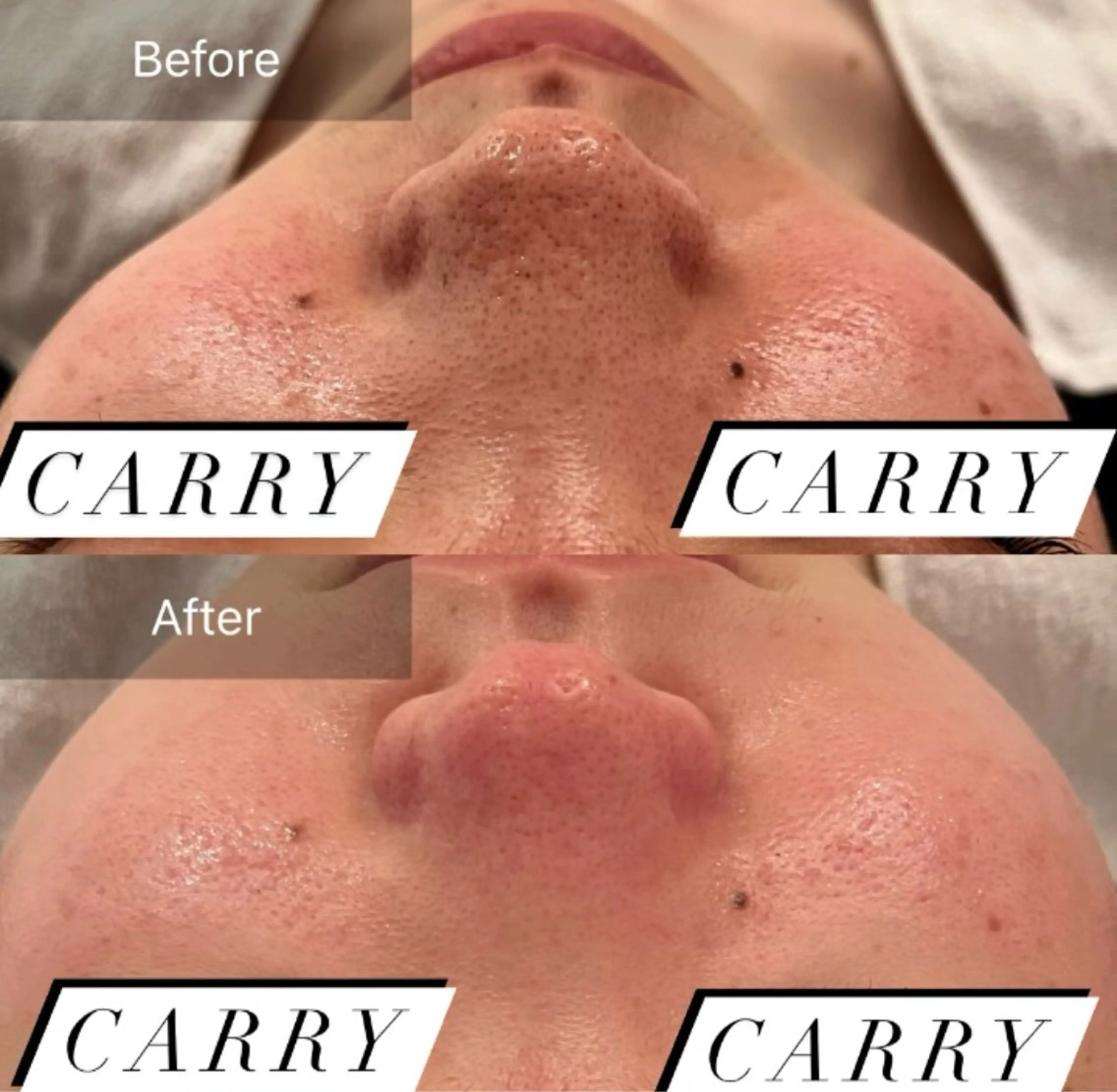 エステ Lune’as Spa 南青山🫧のエステ・リラクイメージ