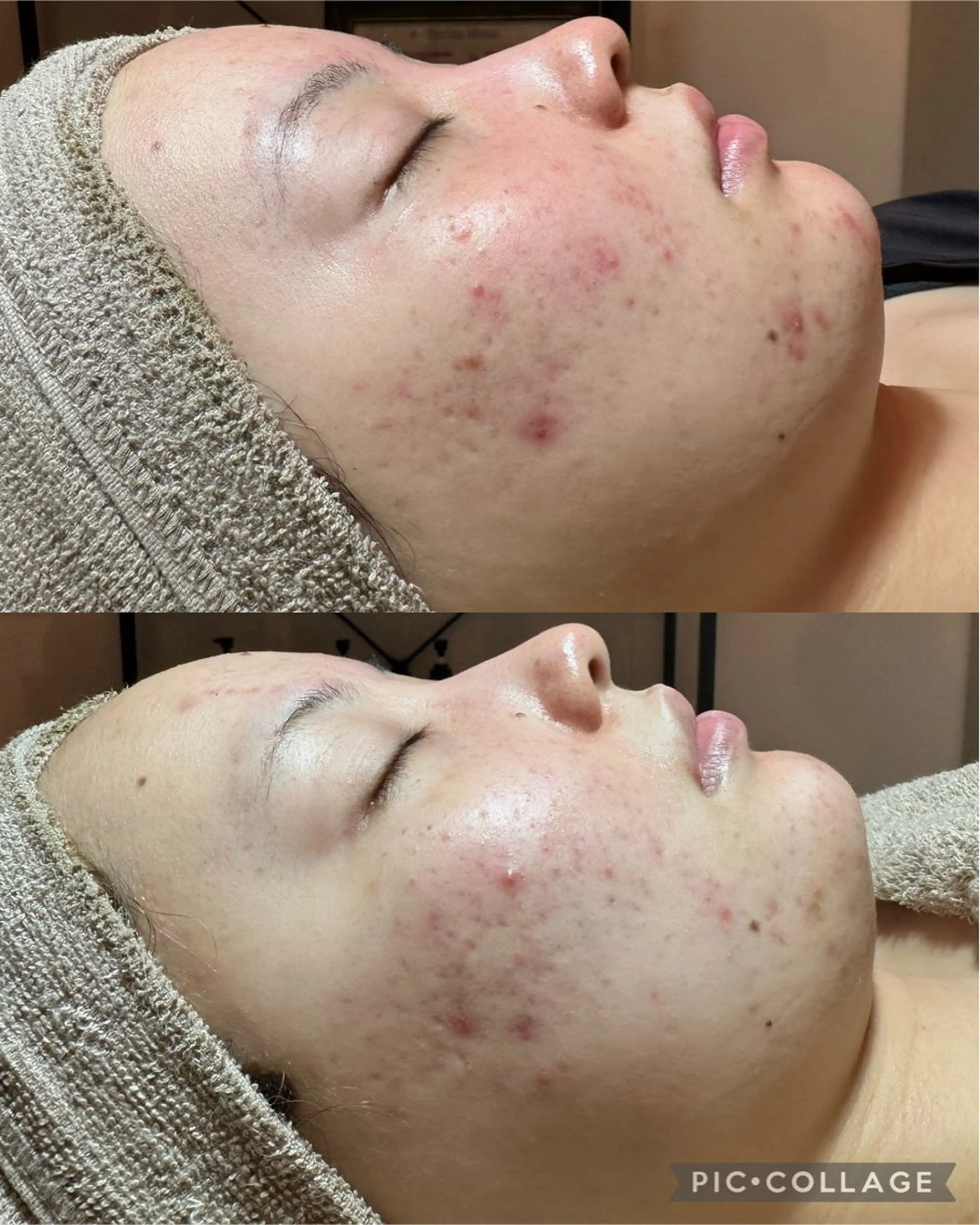 エステ Feel♡ JYURIAのネイルデザイン