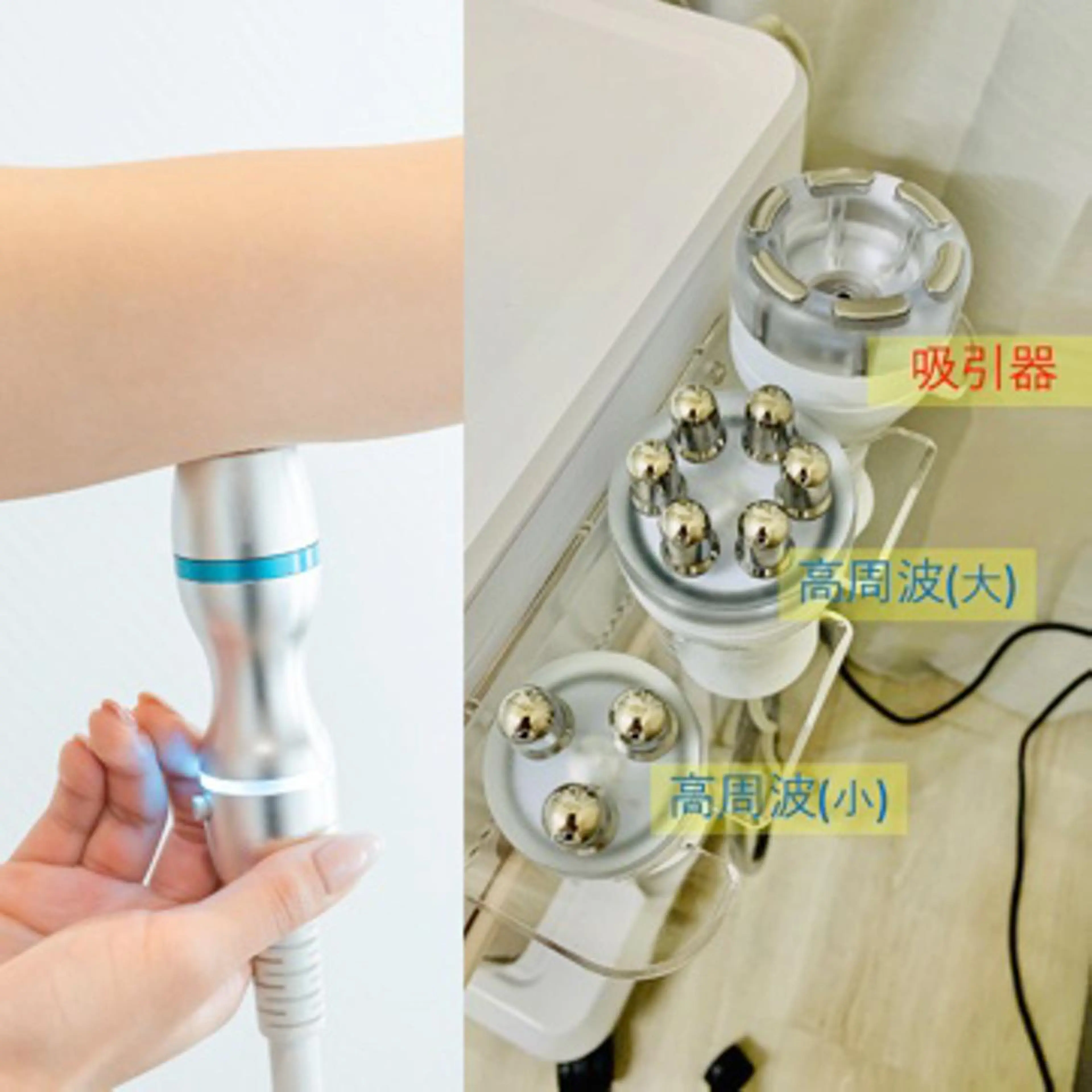 二の腕に特化【魅せる二の腕プラン】★セルフ★ボディ8000S＋高周波9000sの最強組合せ❣️の写真