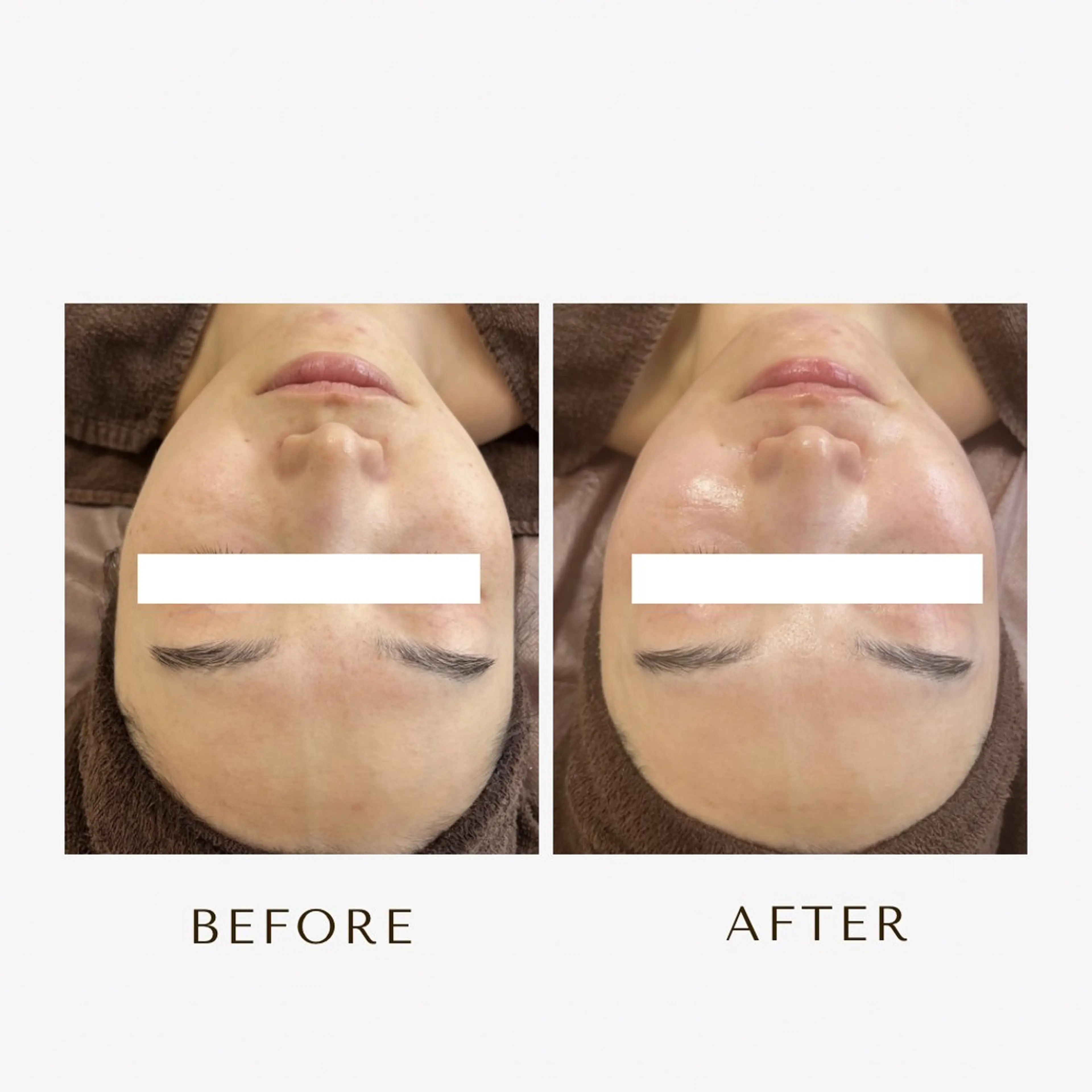 脱毛 1st｜フェイシャル エステ専門店のエステ・リラクイメージ