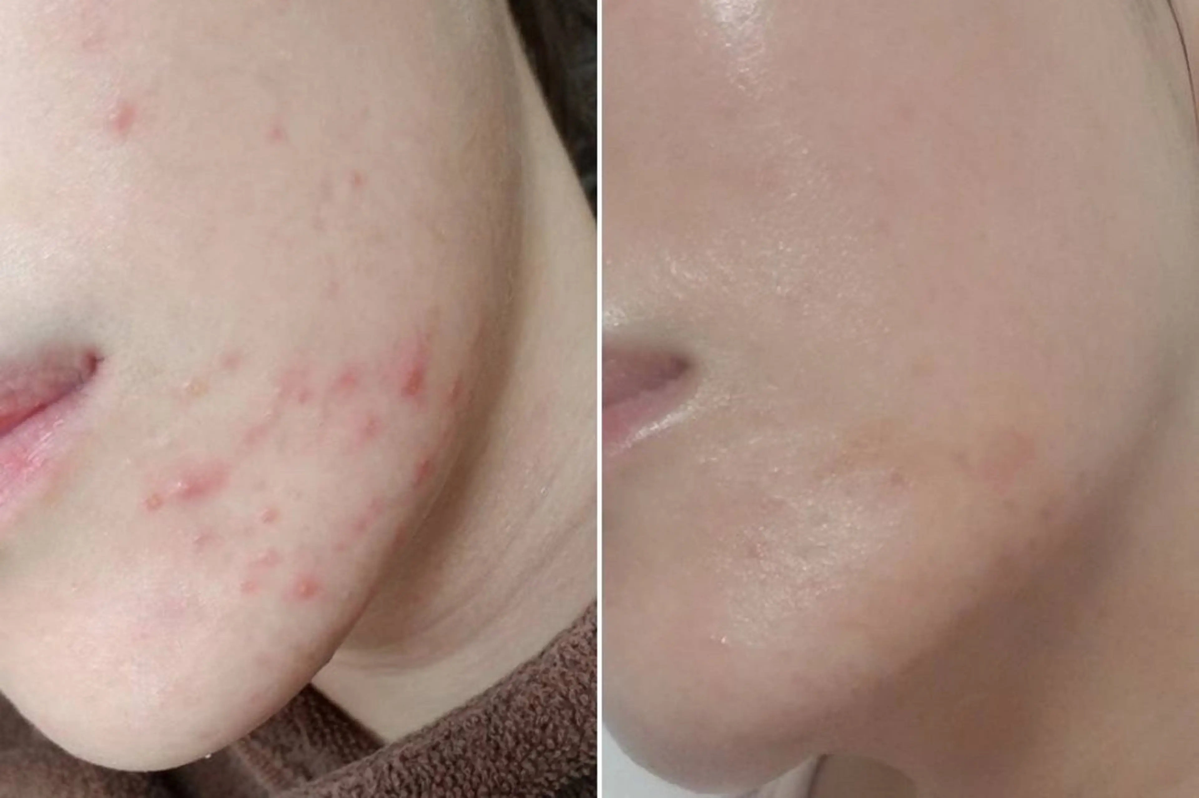 艶肌デトックス🫧 Samiraのエステ・リラクイメージ