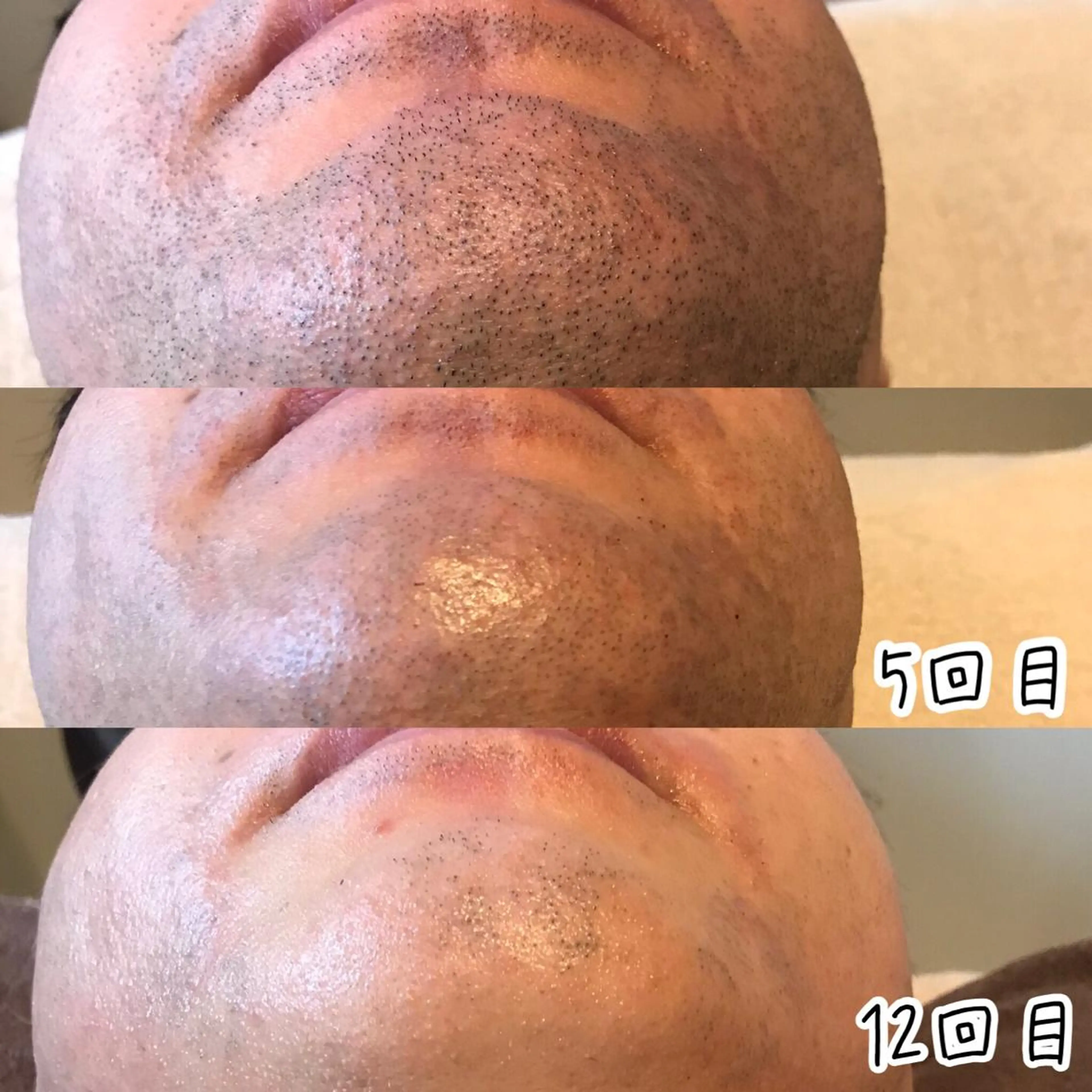 脱毛 浜野 恵美のエステ・リラクイメージ