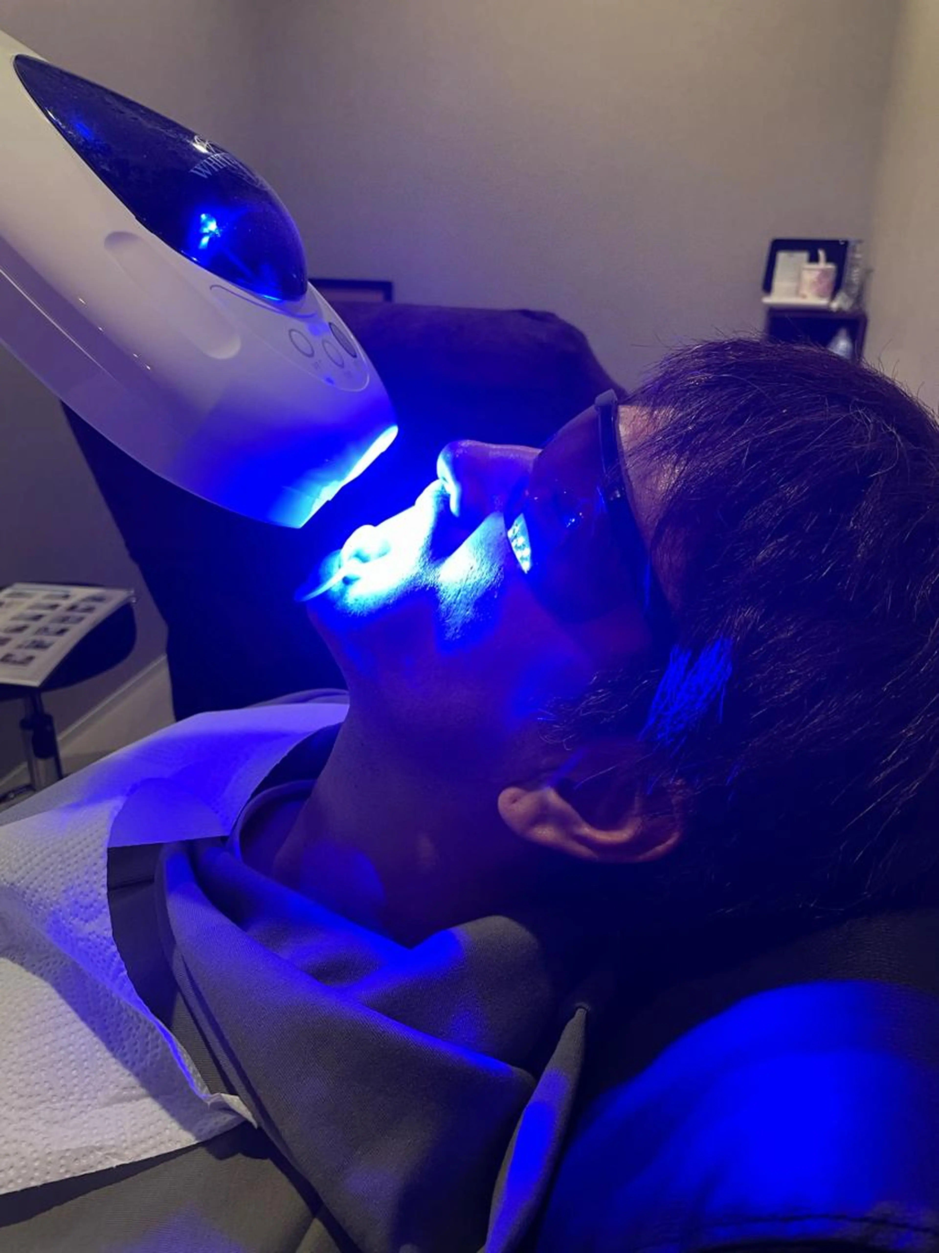 セルフホワイトニング(8分×2)の写真