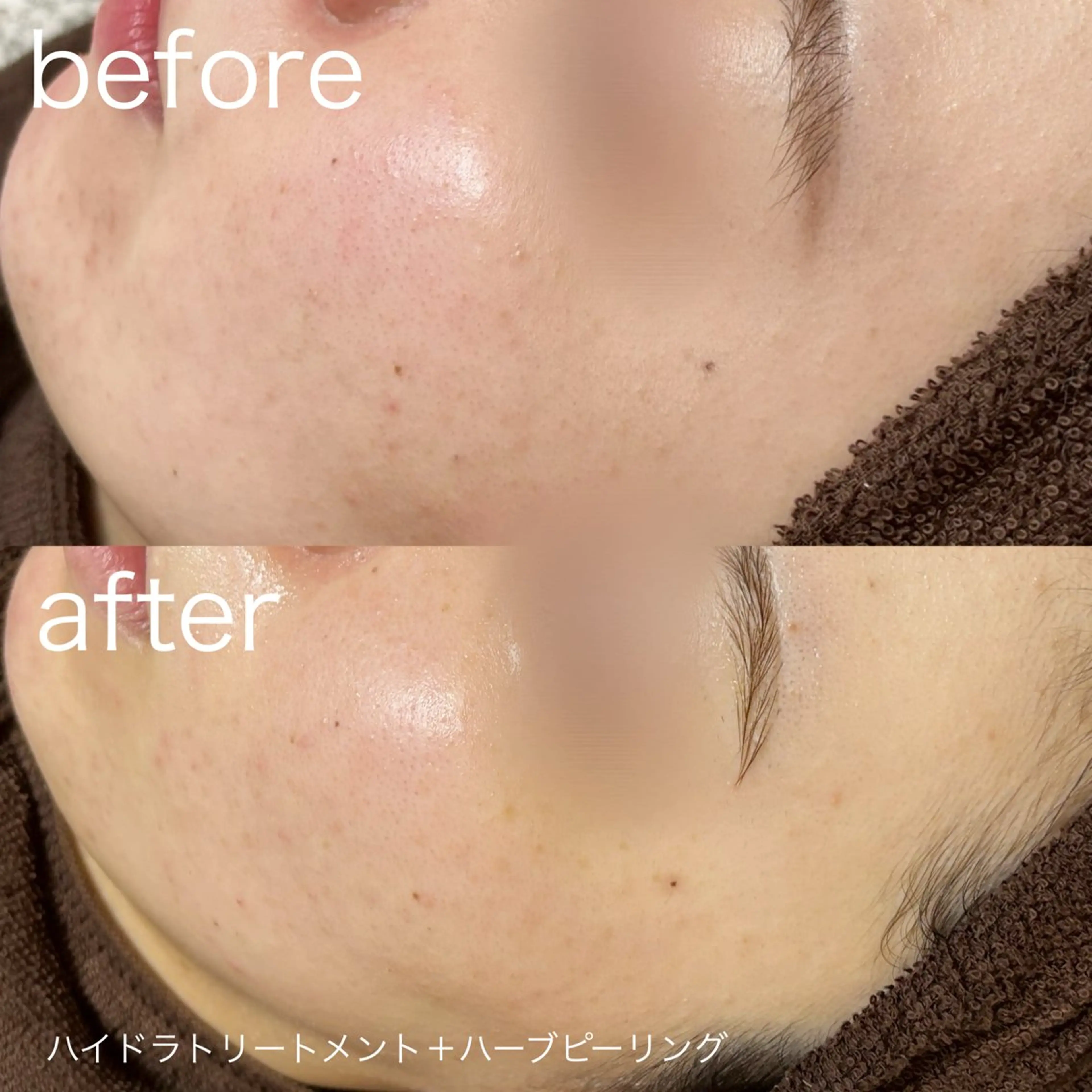 その他 lulularico Yuのエステ・リラクイメージ