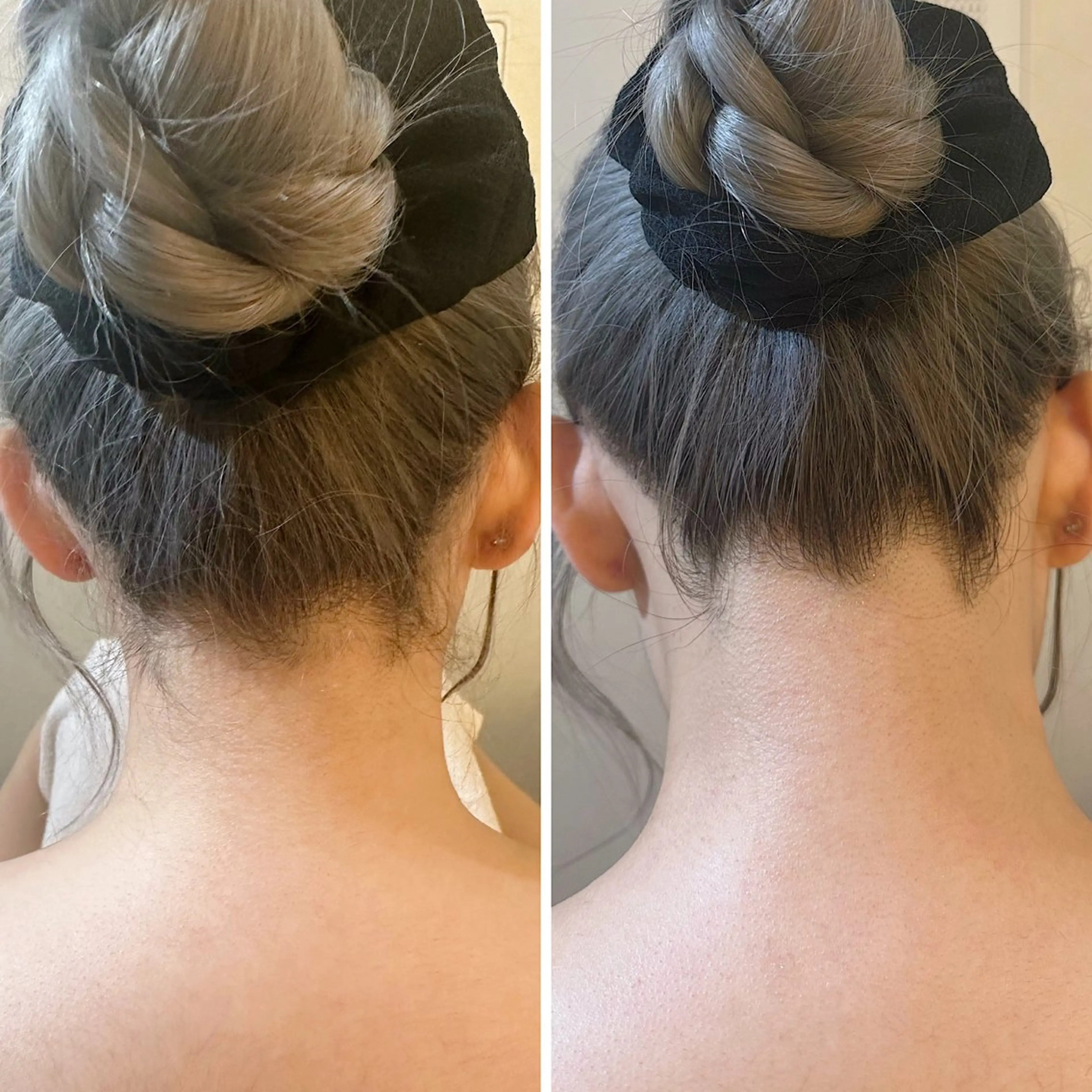 脱毛 うなじ脱毛/美肌脱毛 LABELのエステ・リラクイメージ