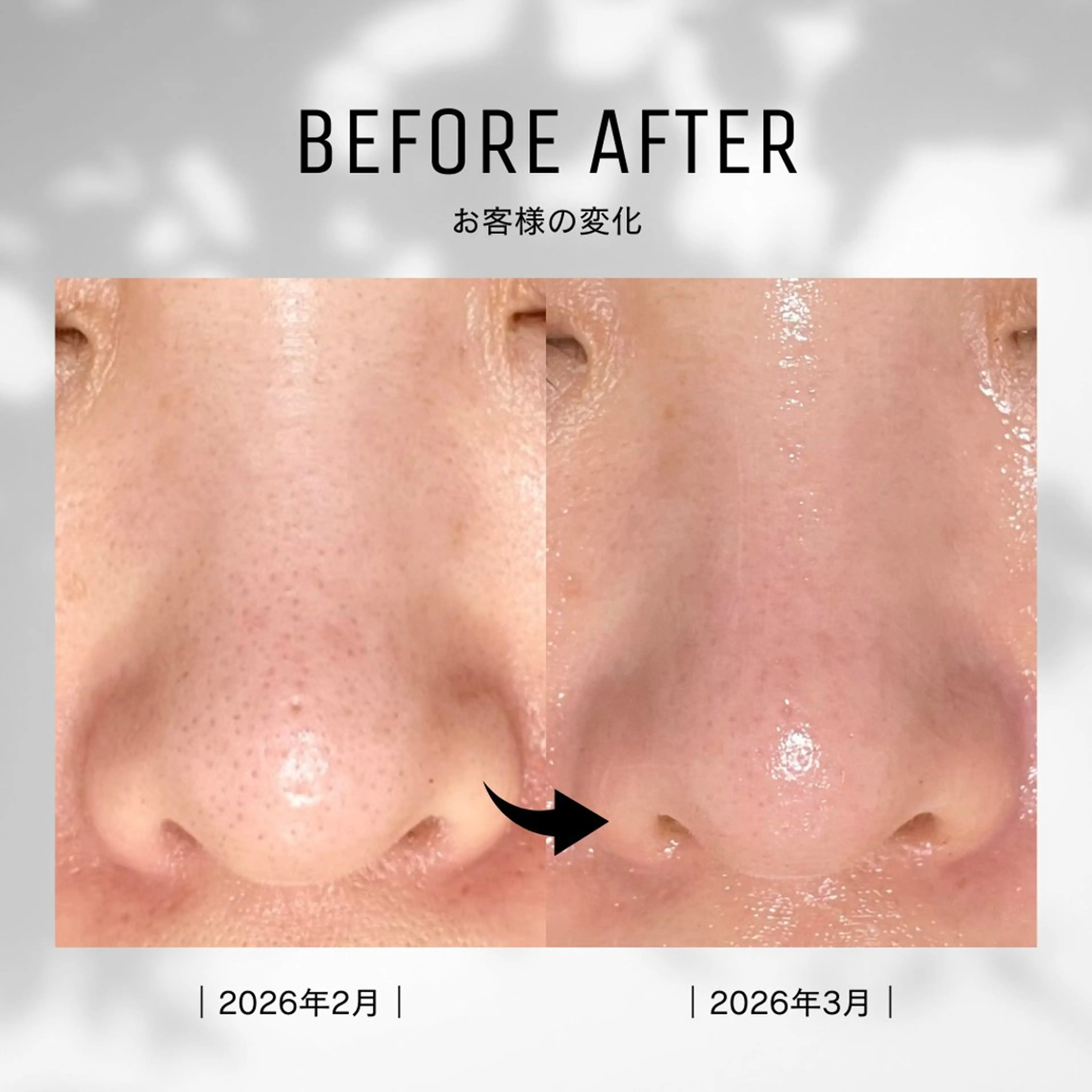 エステ プライベートサロン Belle（ベル）のエステ・リラクイメージ