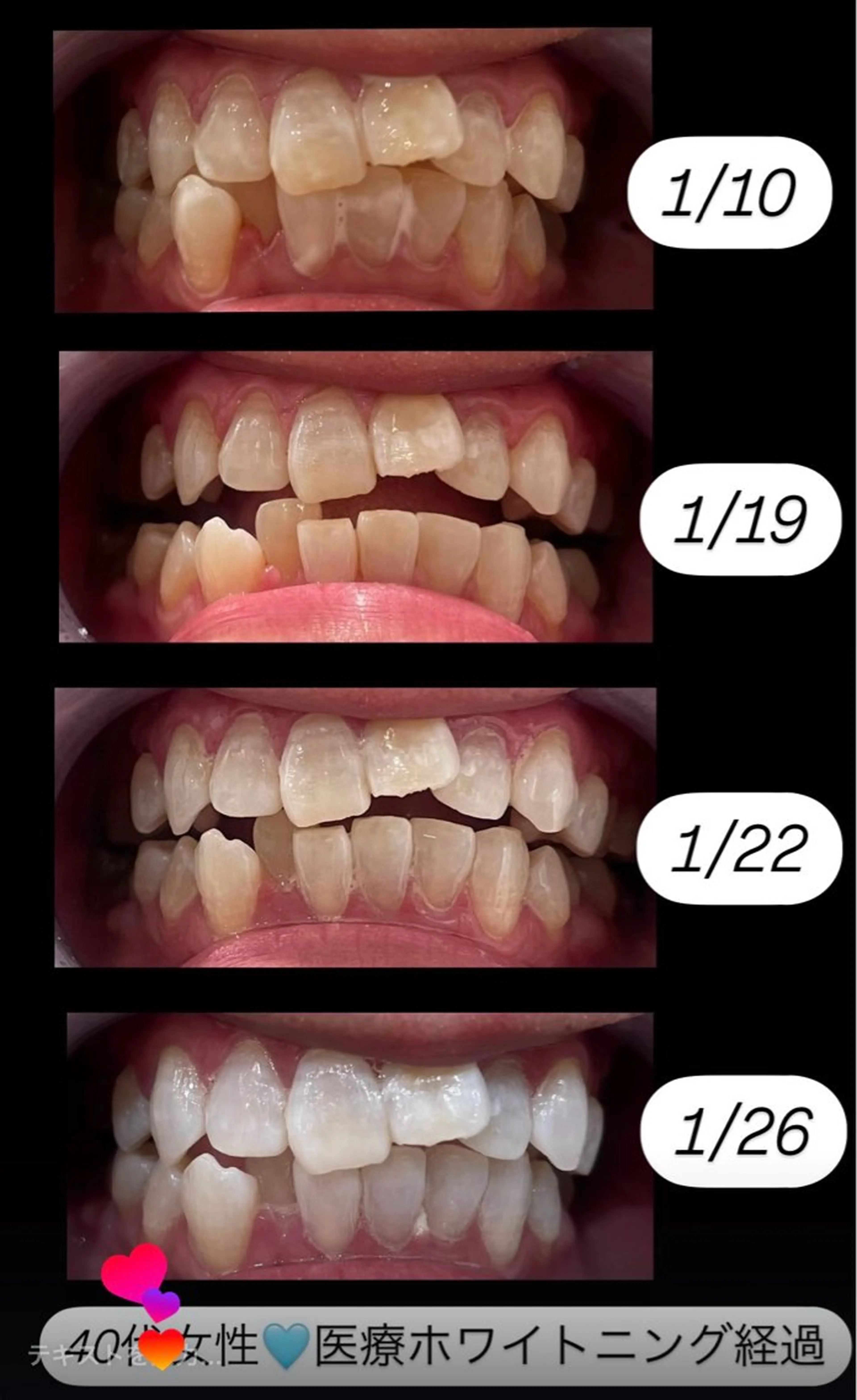 Kaula ホワイトニング🦷✨のエステ・リラクイメージ