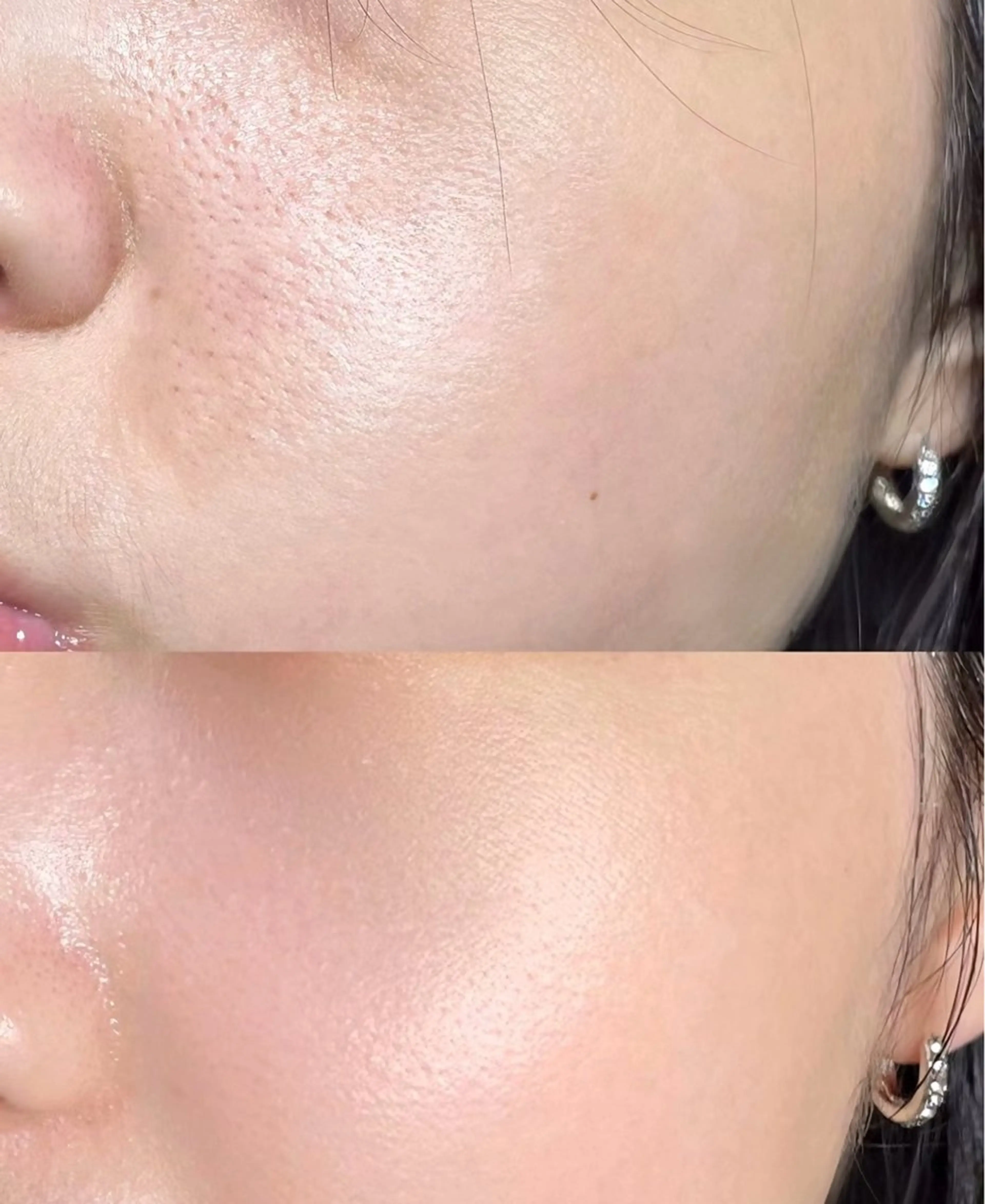 マツエク・マツパ 結婚式・ブライダル エステ aliaハイフ&水光ジェットサロン所属・aliaハーブ水光店 エステティシャン募集のエステ・リラクイメージ