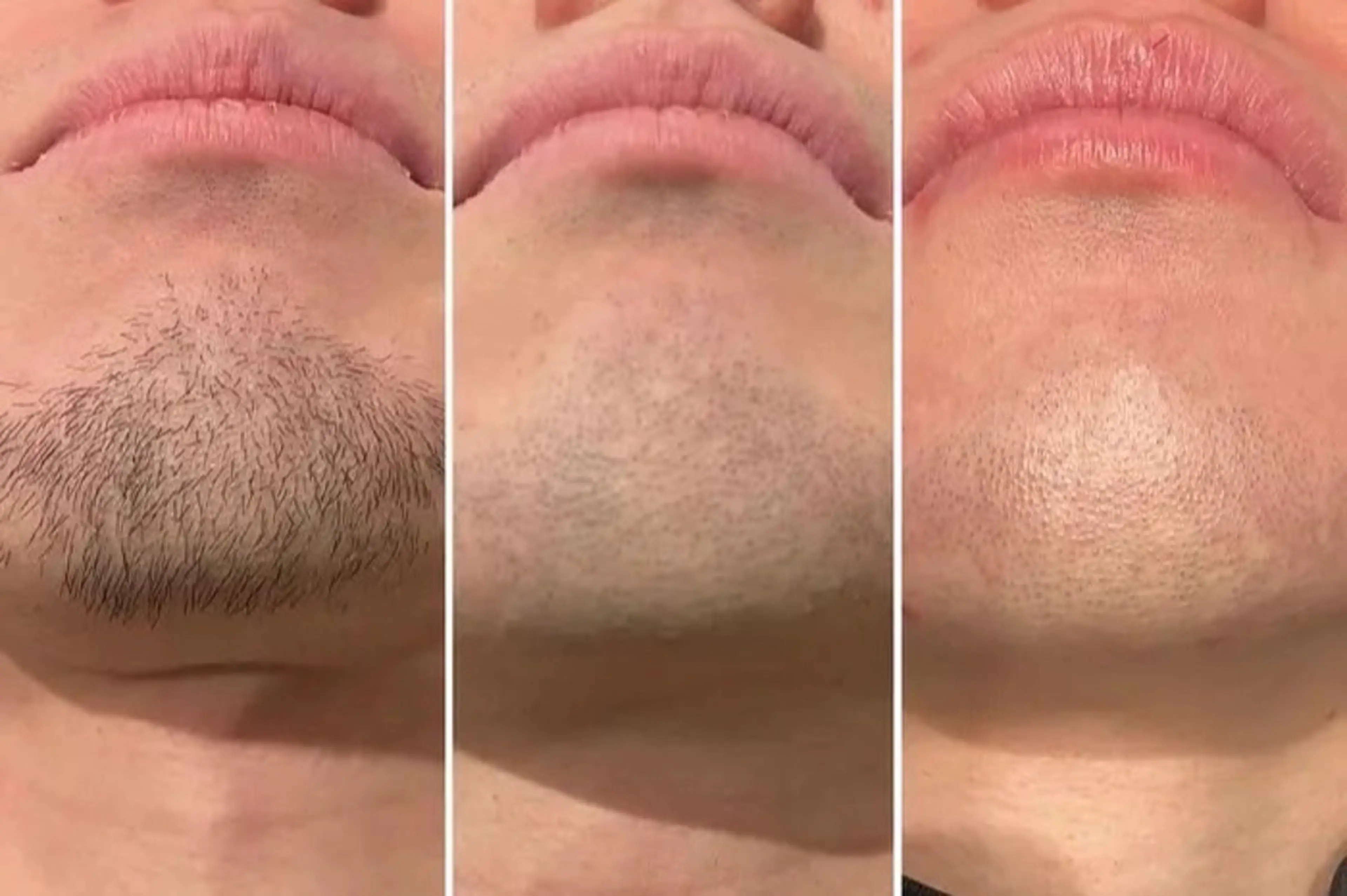 脱毛 Noguchi staffのエステ・リラクイメージ