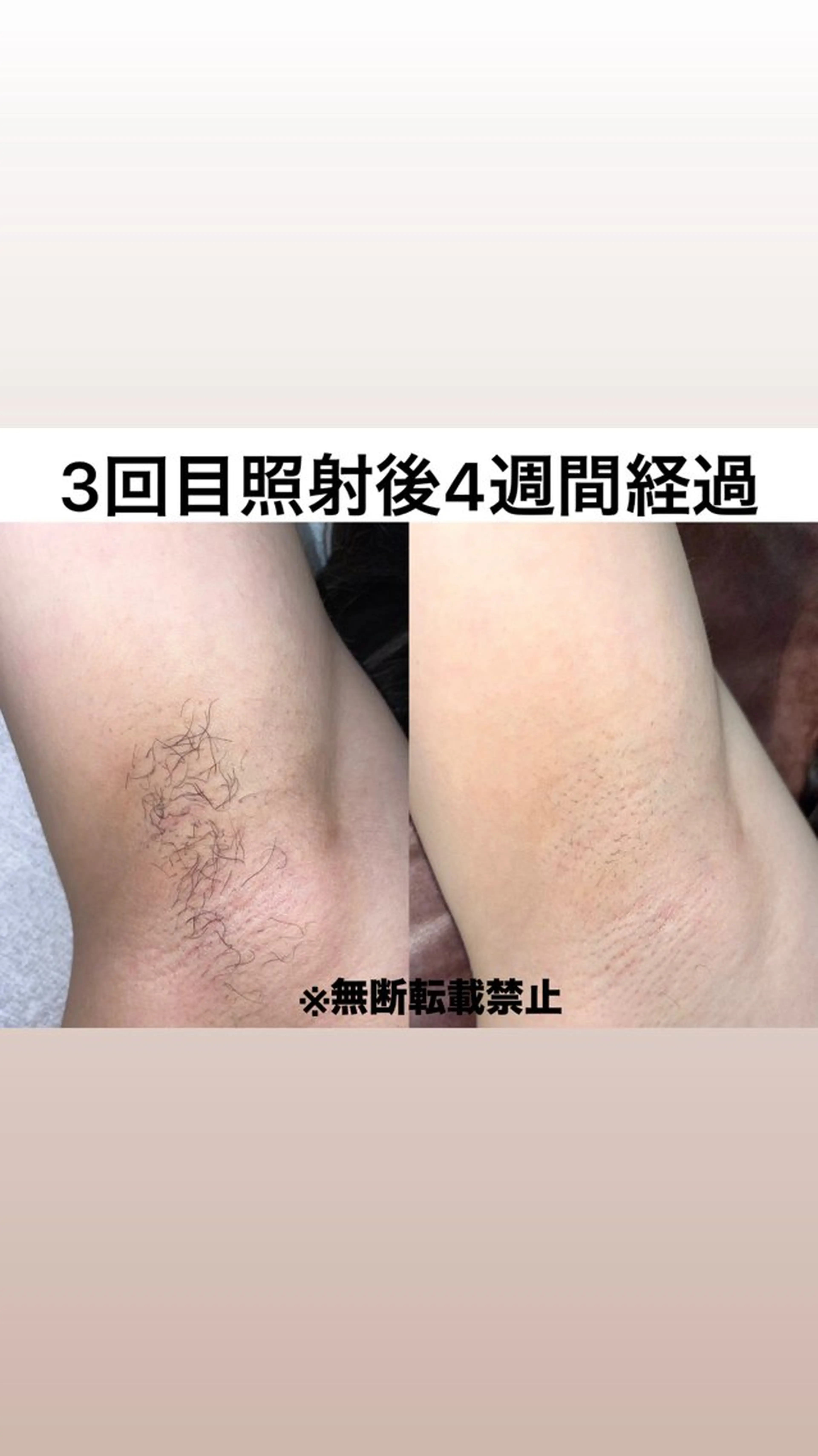 キッズ 脱毛 親子脱毛サロン ReOluのエステ・リラクイメージ