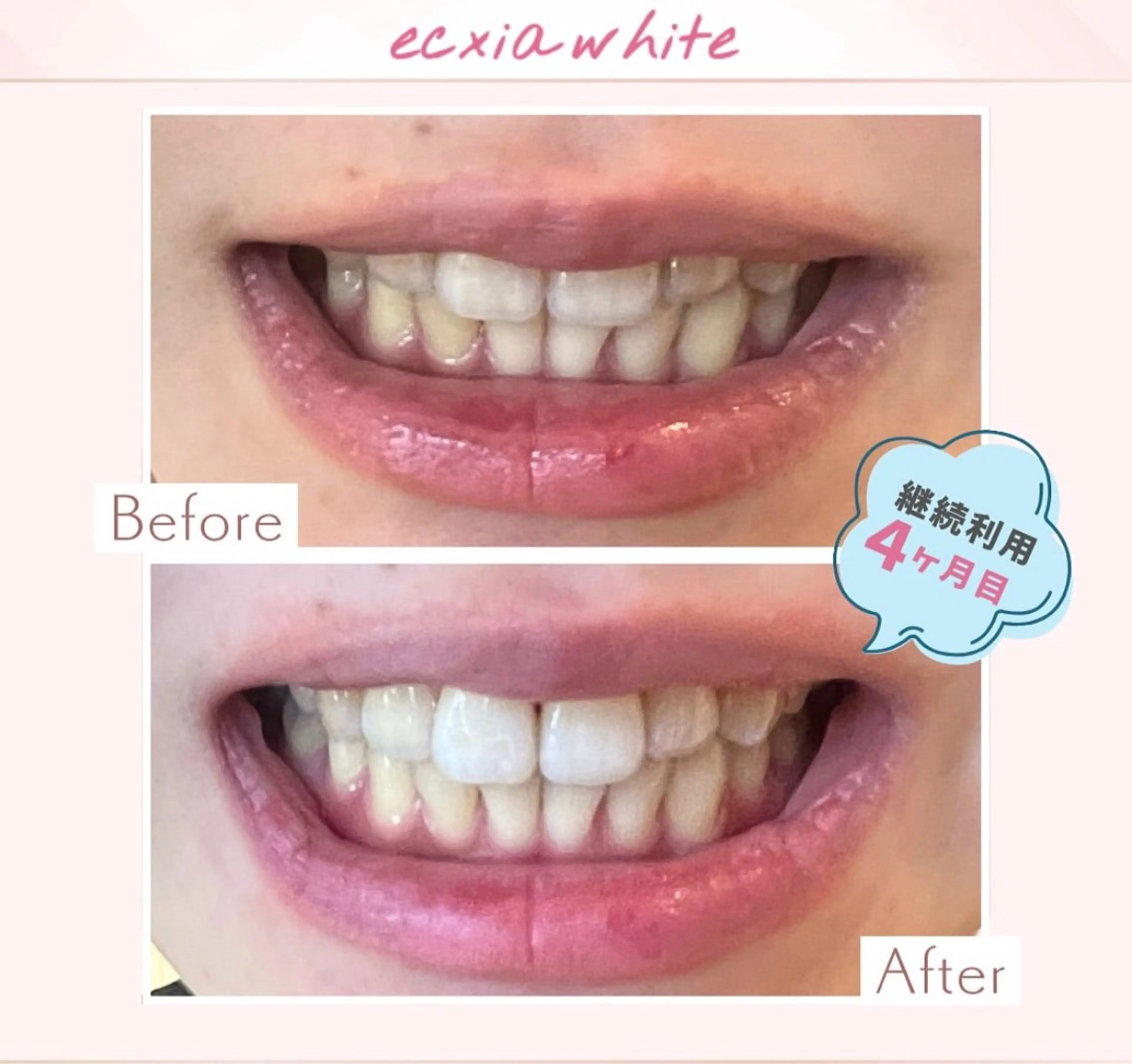 yumi❤︎ ホワイトニングのその他イメージ