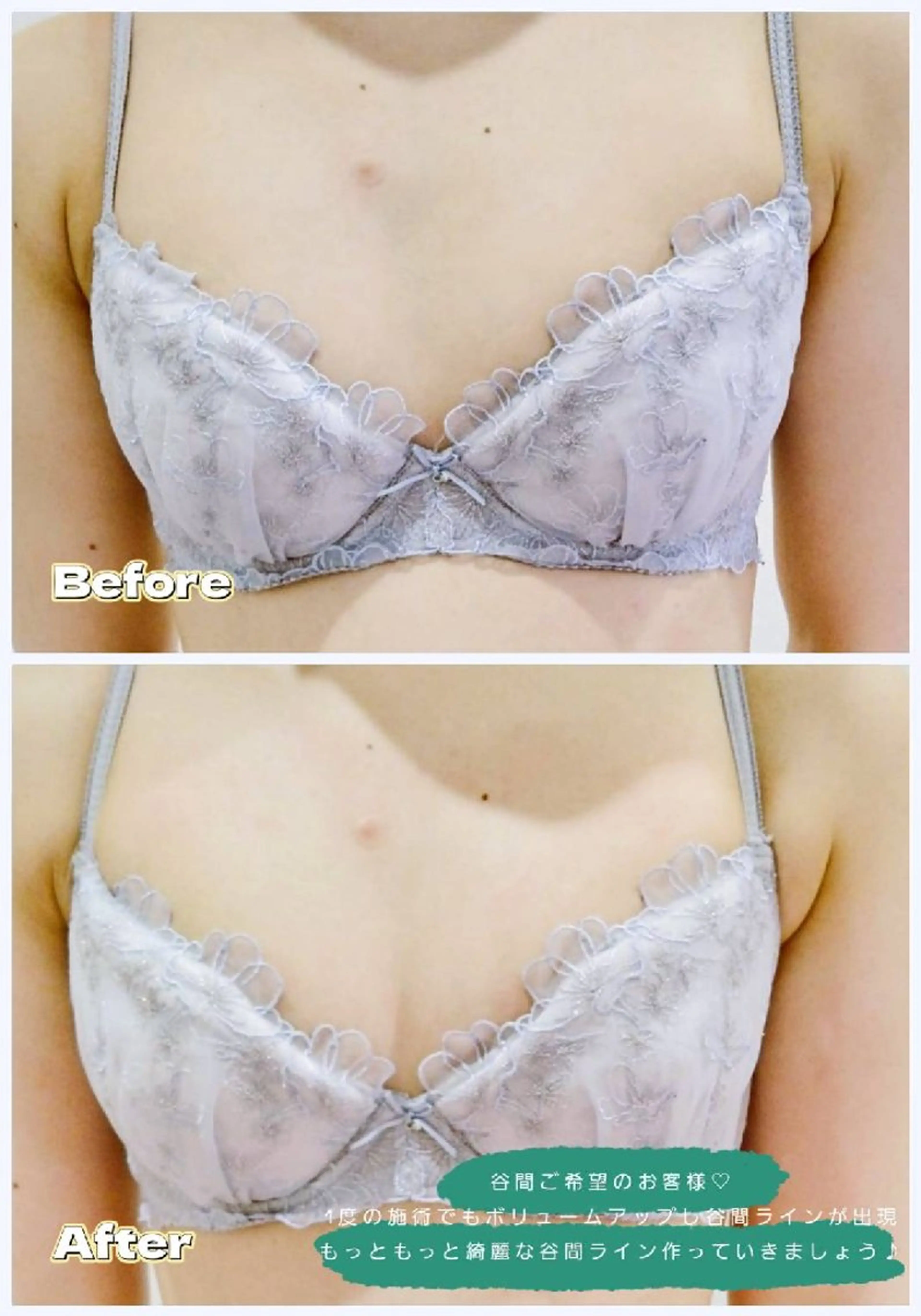 マシュマロバスト coucouのエステ・リラクイメージ