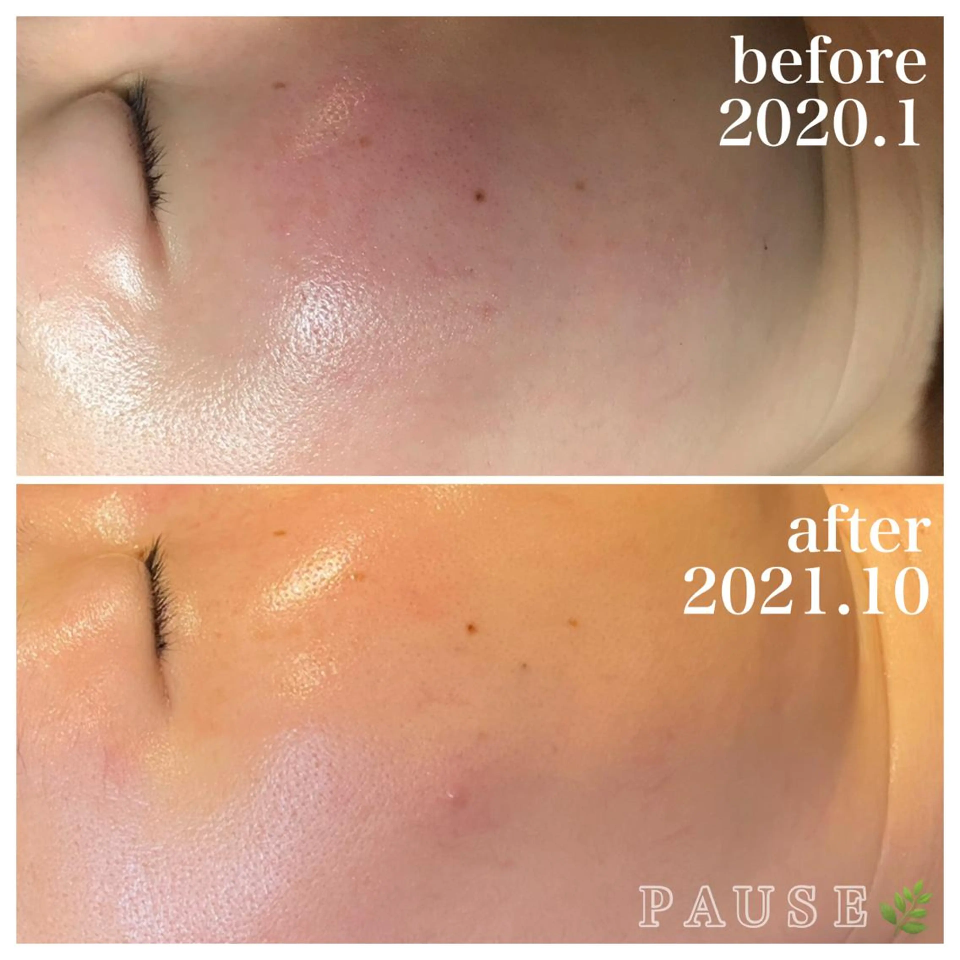 エステ 浜野 恵美のエステ・リラクイメージ