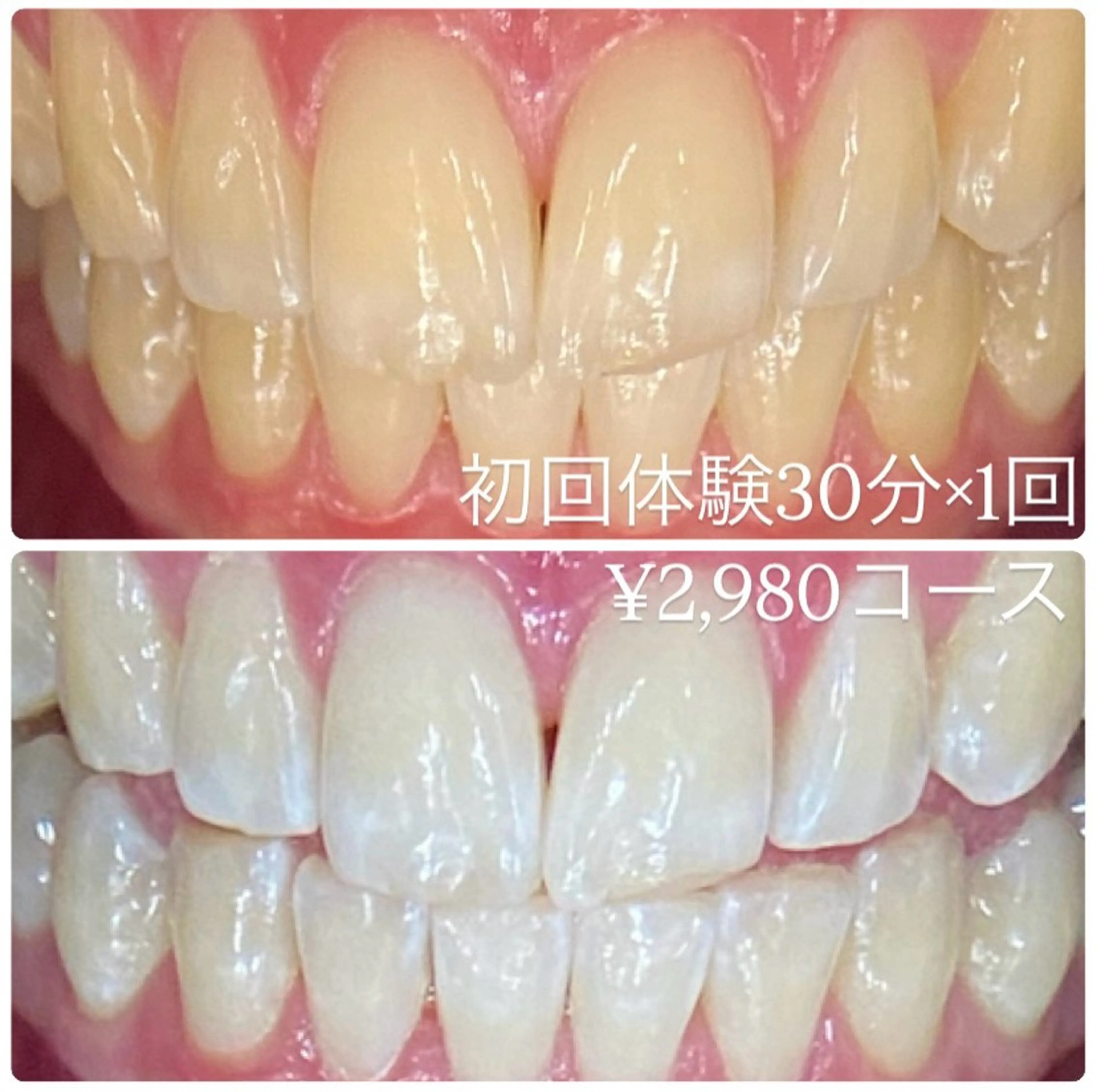 PLATINUM Beauty 横浜店所属・ホワイトニングルーム 横浜店のその他イメージ