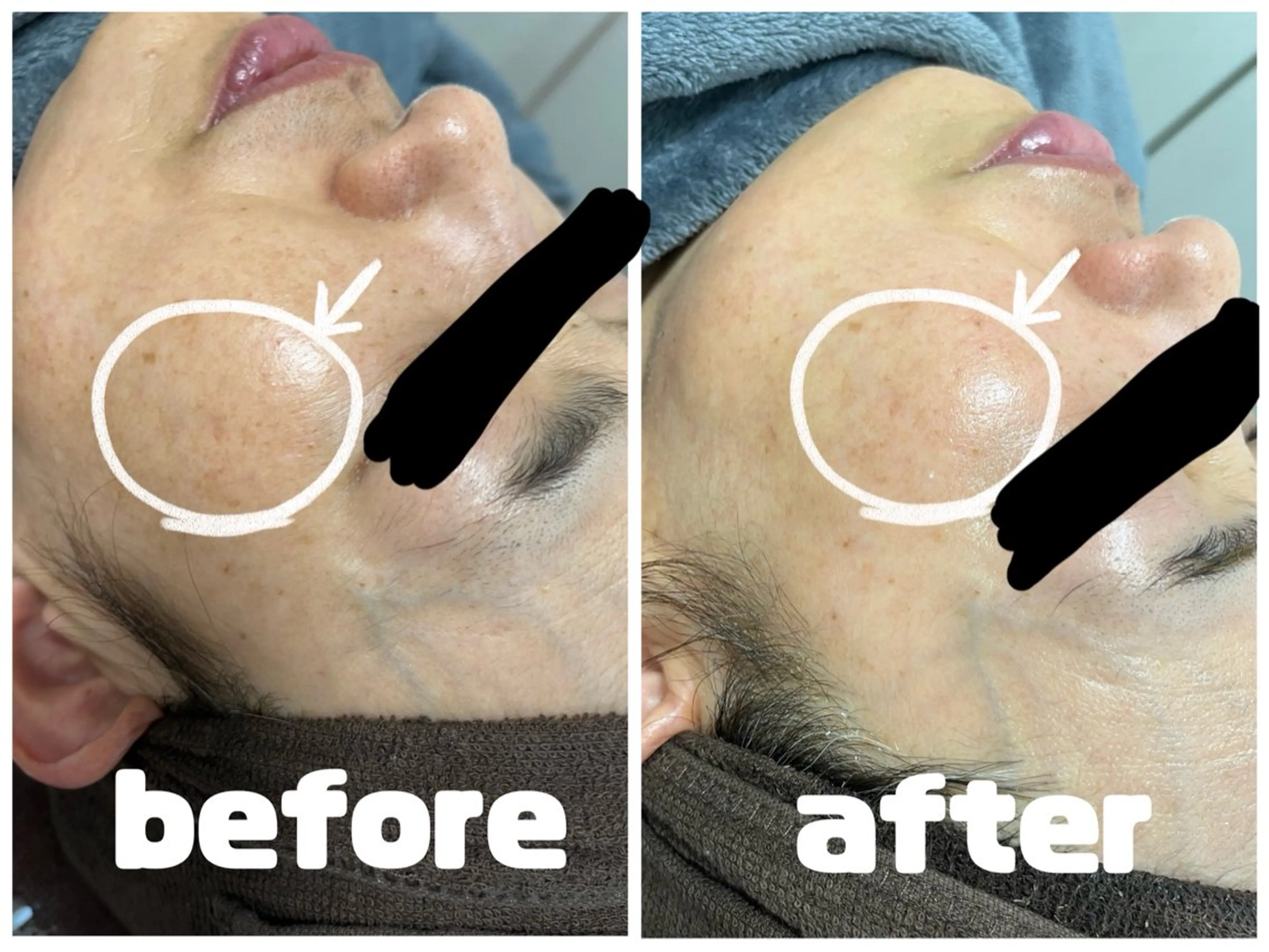 エステ SALON MAREのネイルデザイン