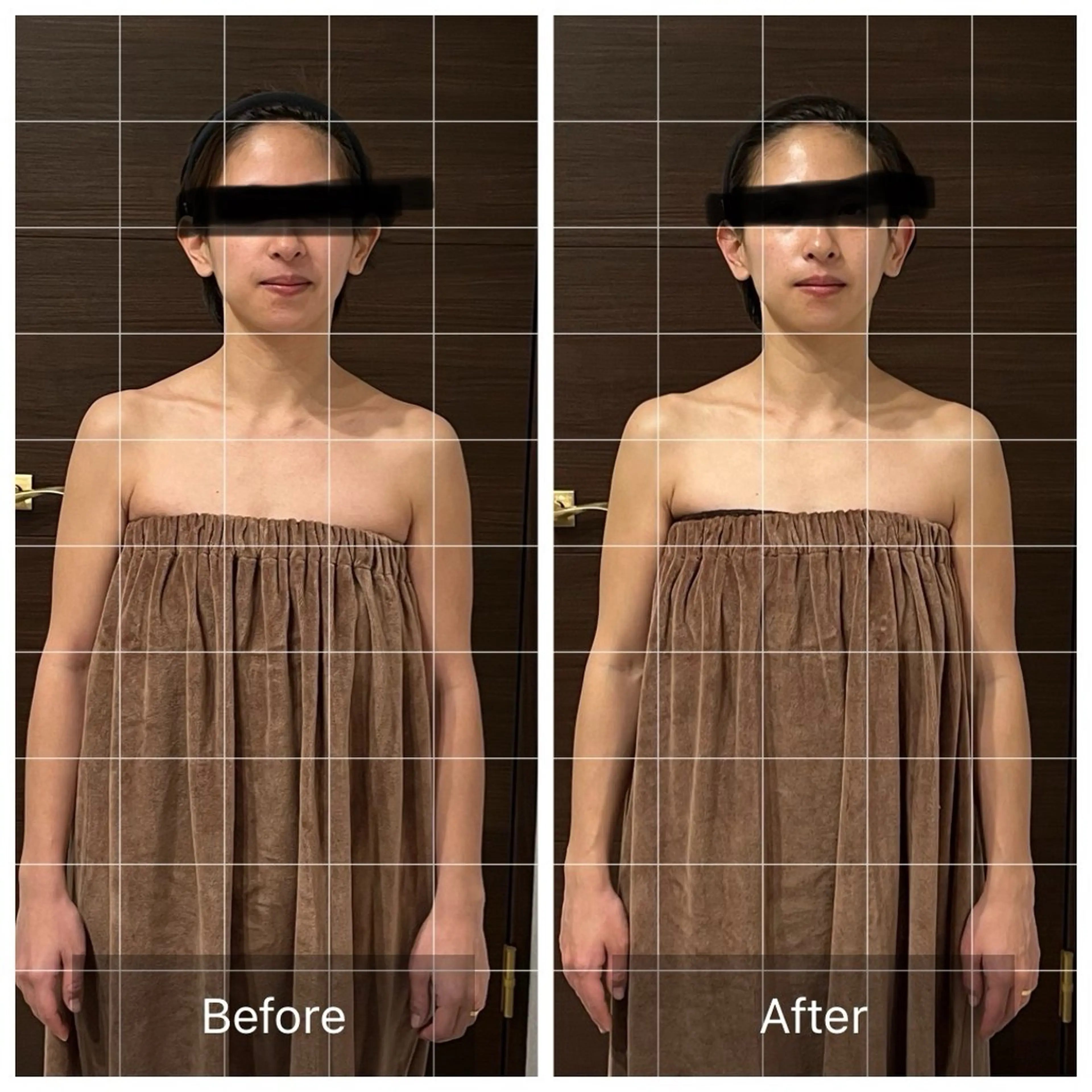 脳洗浄®︎小顔調整70分の写真