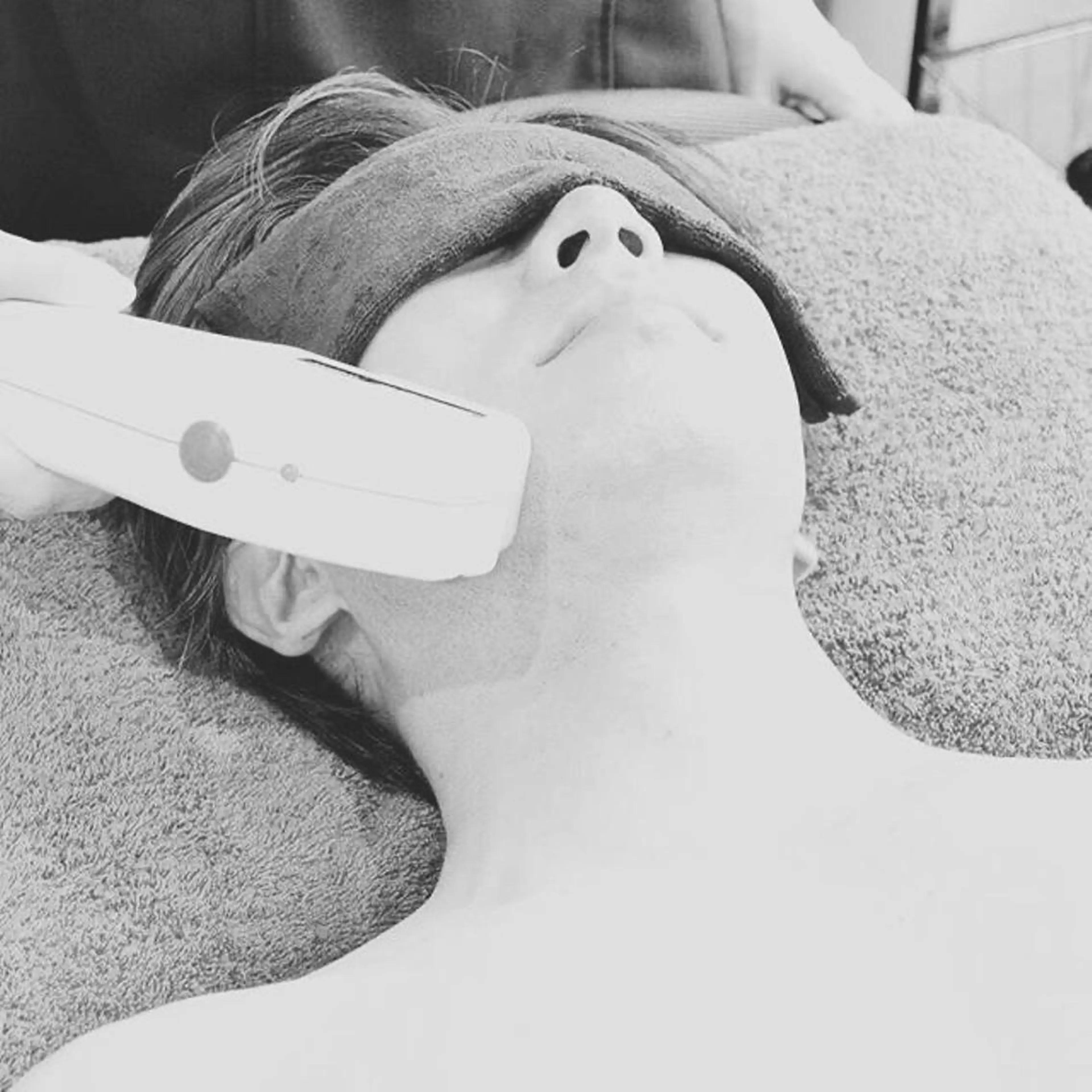 メンズヒゲ脱毛の写真