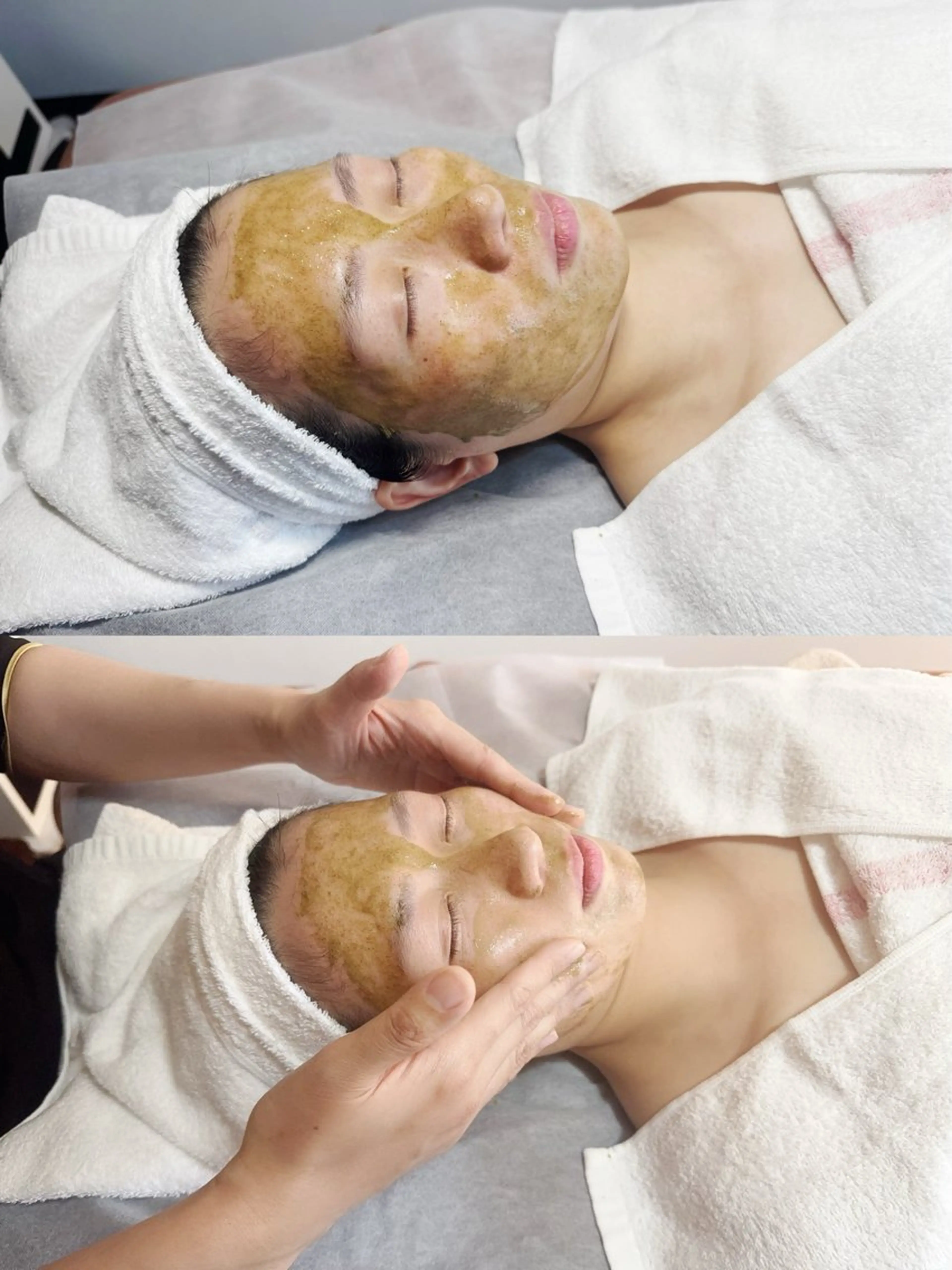 【ニキビケア・毛穴】剥離なし漢方ハーブピーリング+ デコルテ 60分/6980の写真