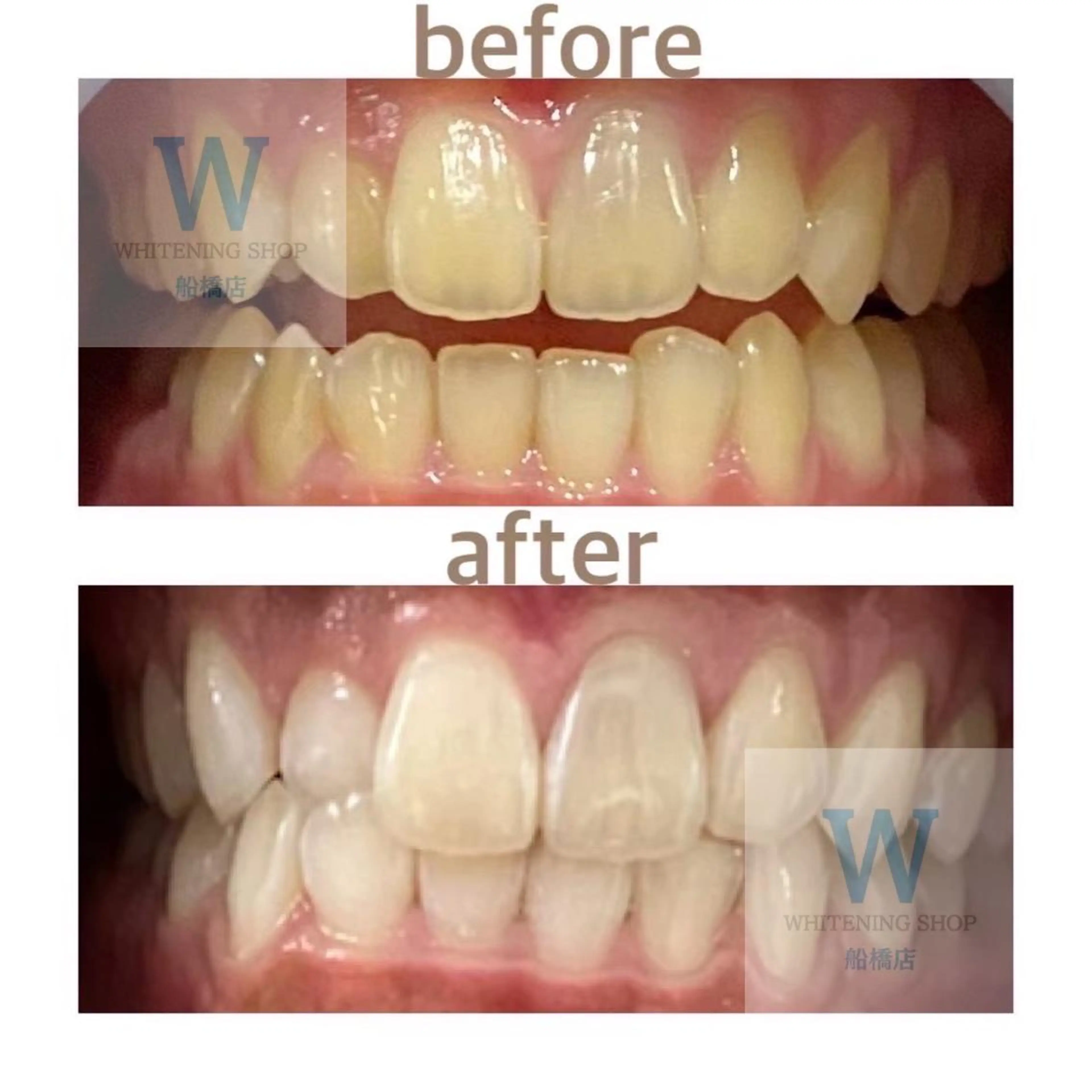 エステ リラク ホワイトニング ショップ船橋店🦷のエステ・リラクイメージ