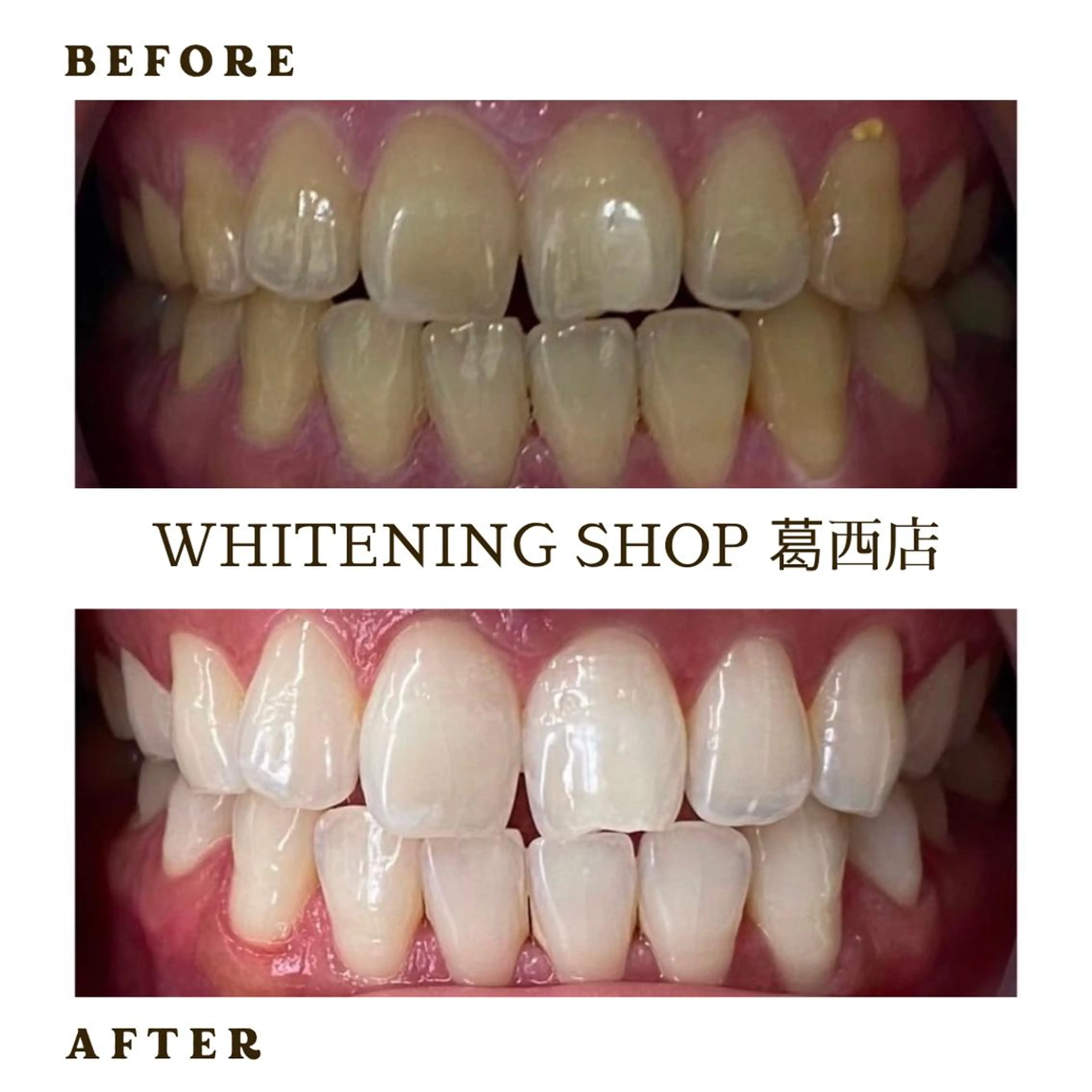 メンズ その他 ホワイトニング ショップ葛西店のその他イメージ