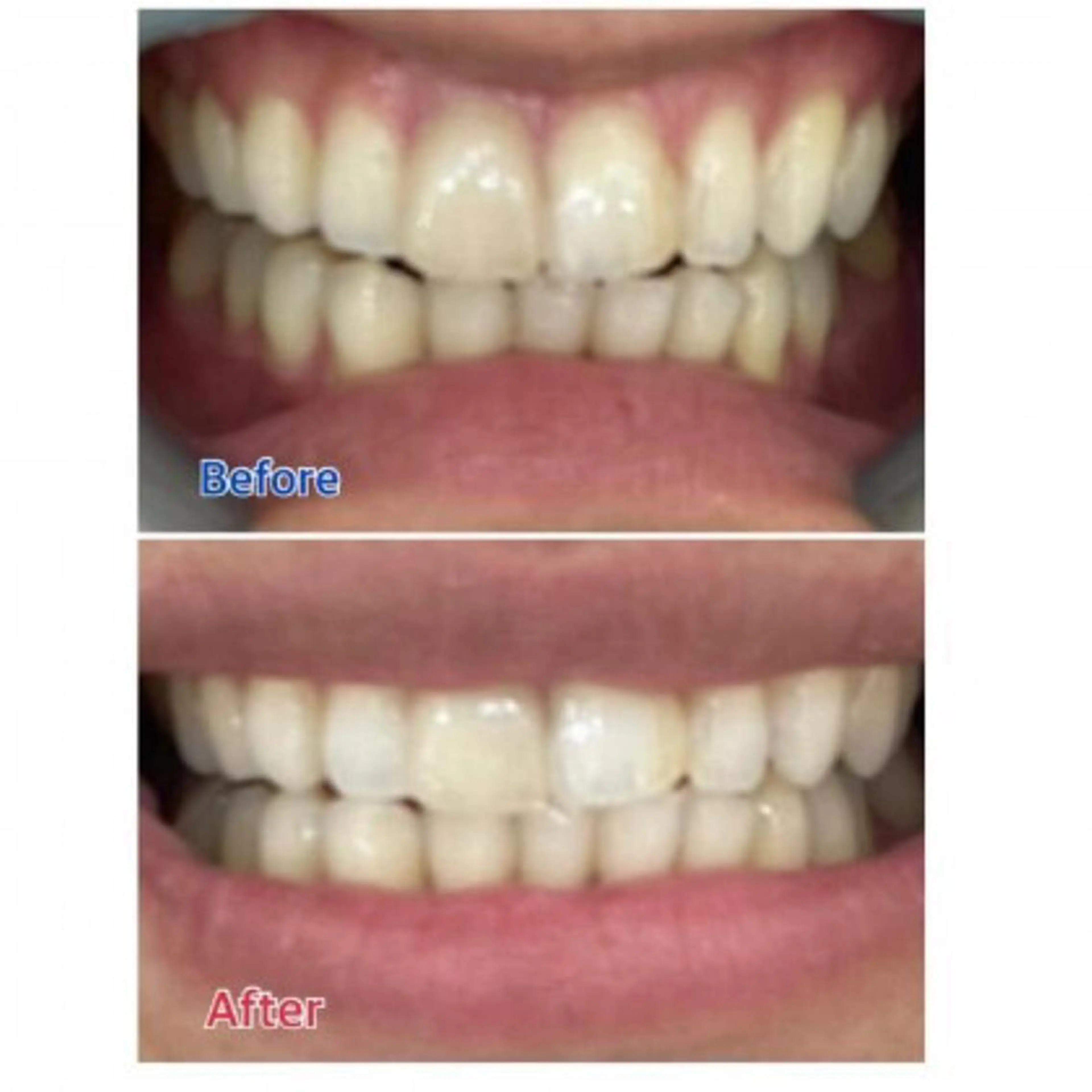 Ｍ渋谷 ホワイトニングのエステ・リラクイメージ