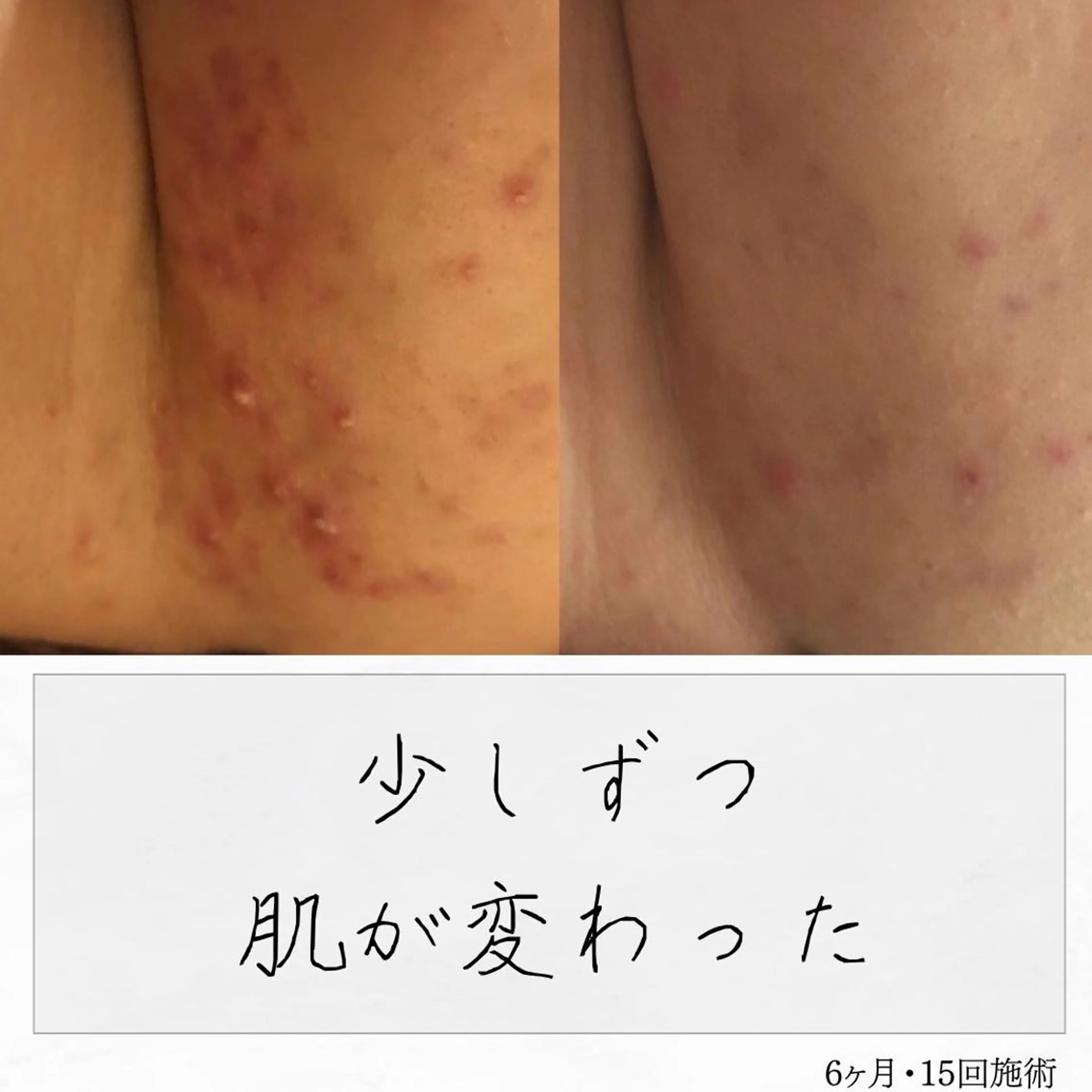 ニキビ経験者が施術 する専門サロン🌻のエステ・リラクイメージ