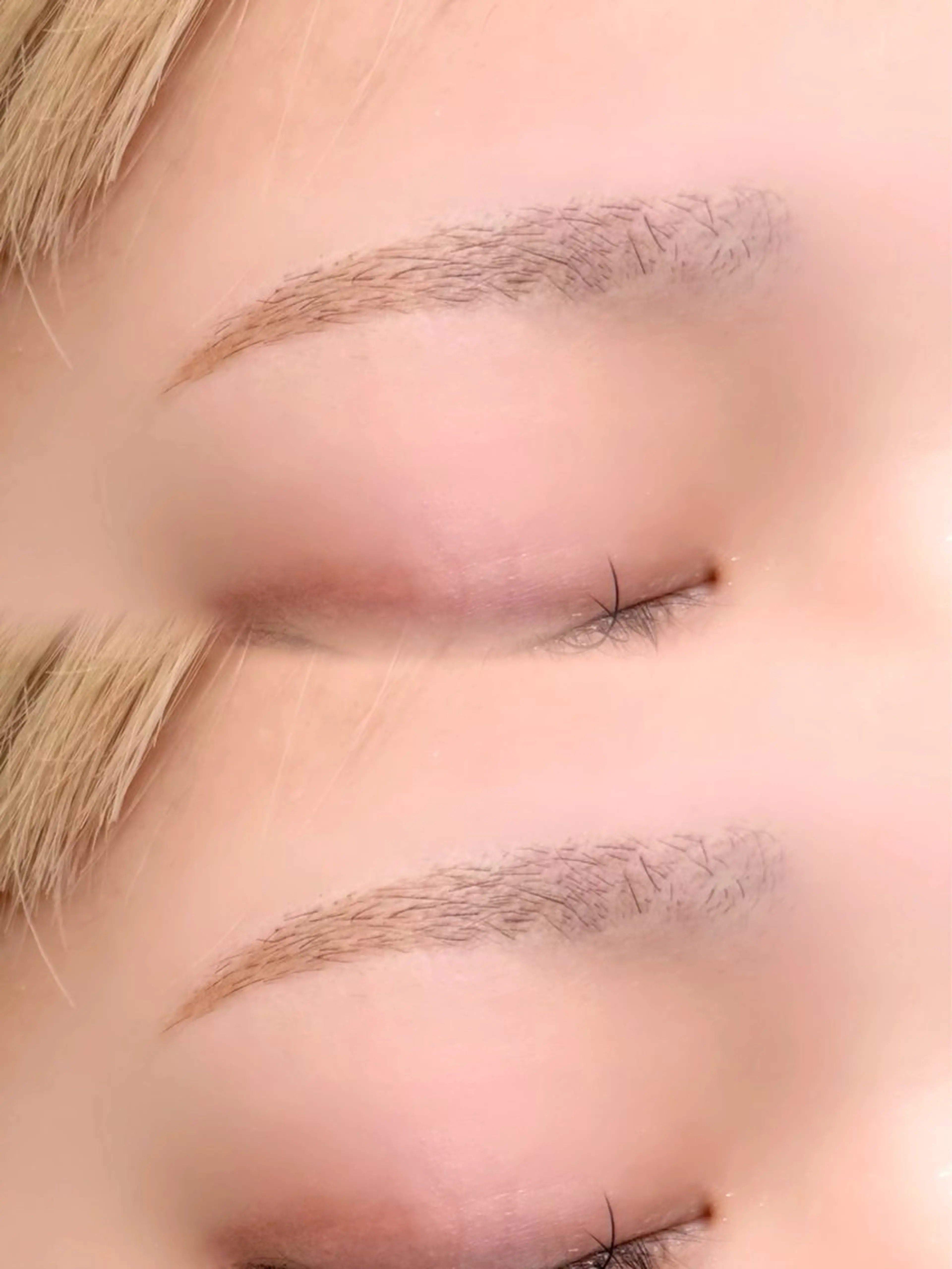 ワックス脱毛の写真