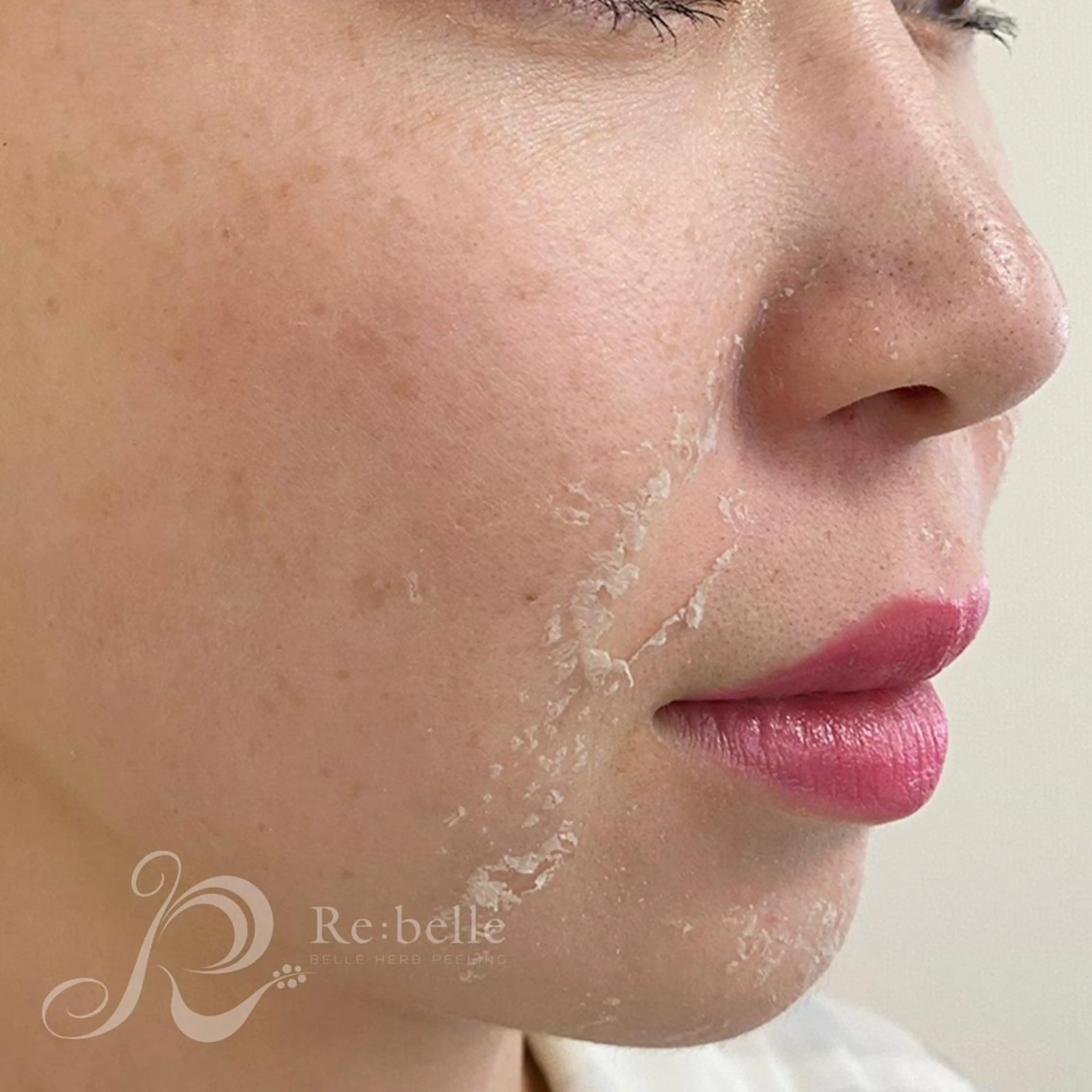 エステ 肌質改善サロン Ｌａｖｉ＆のその他イメージ