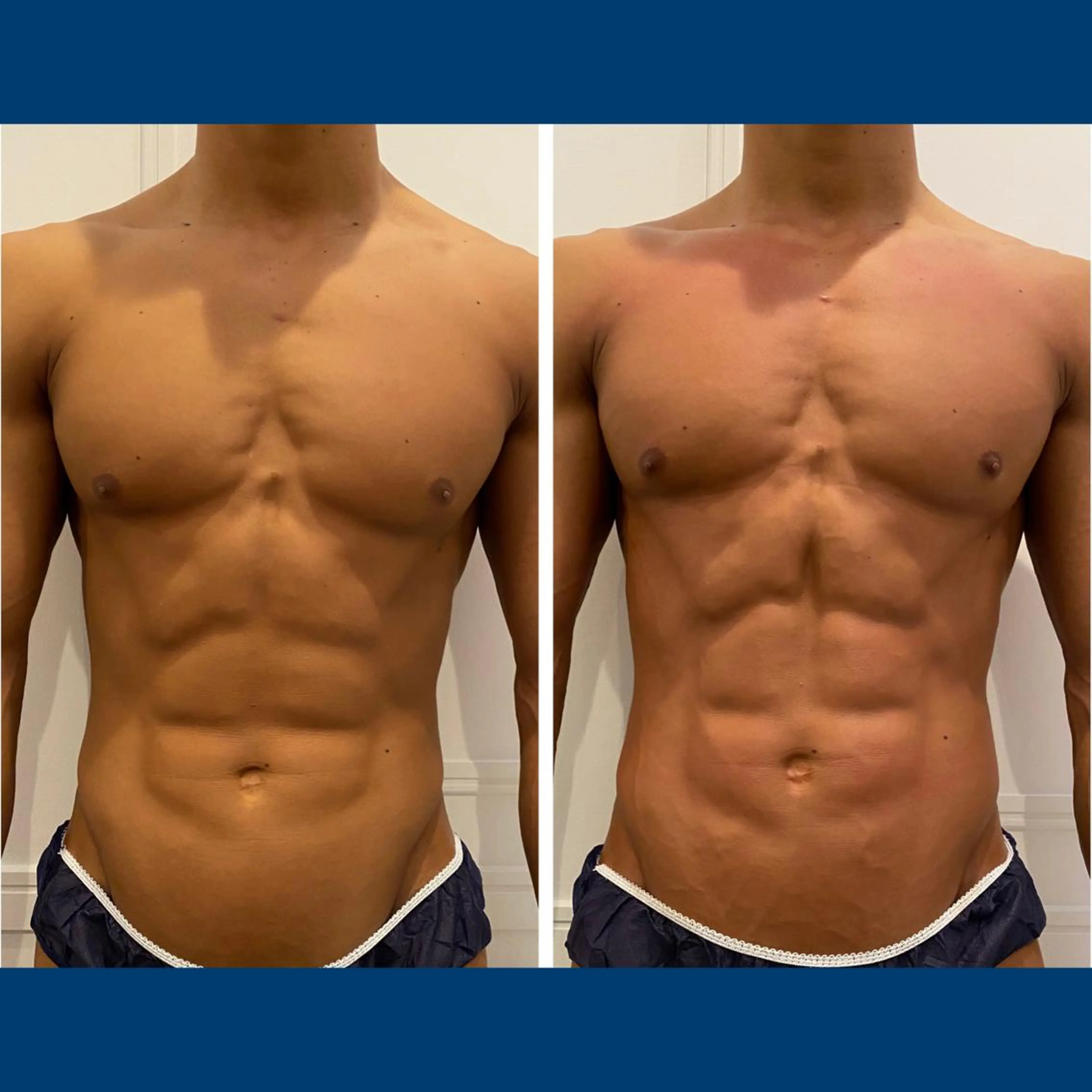 小顔EX心斎橋 REVIハーブのエステ・リラクイメージ