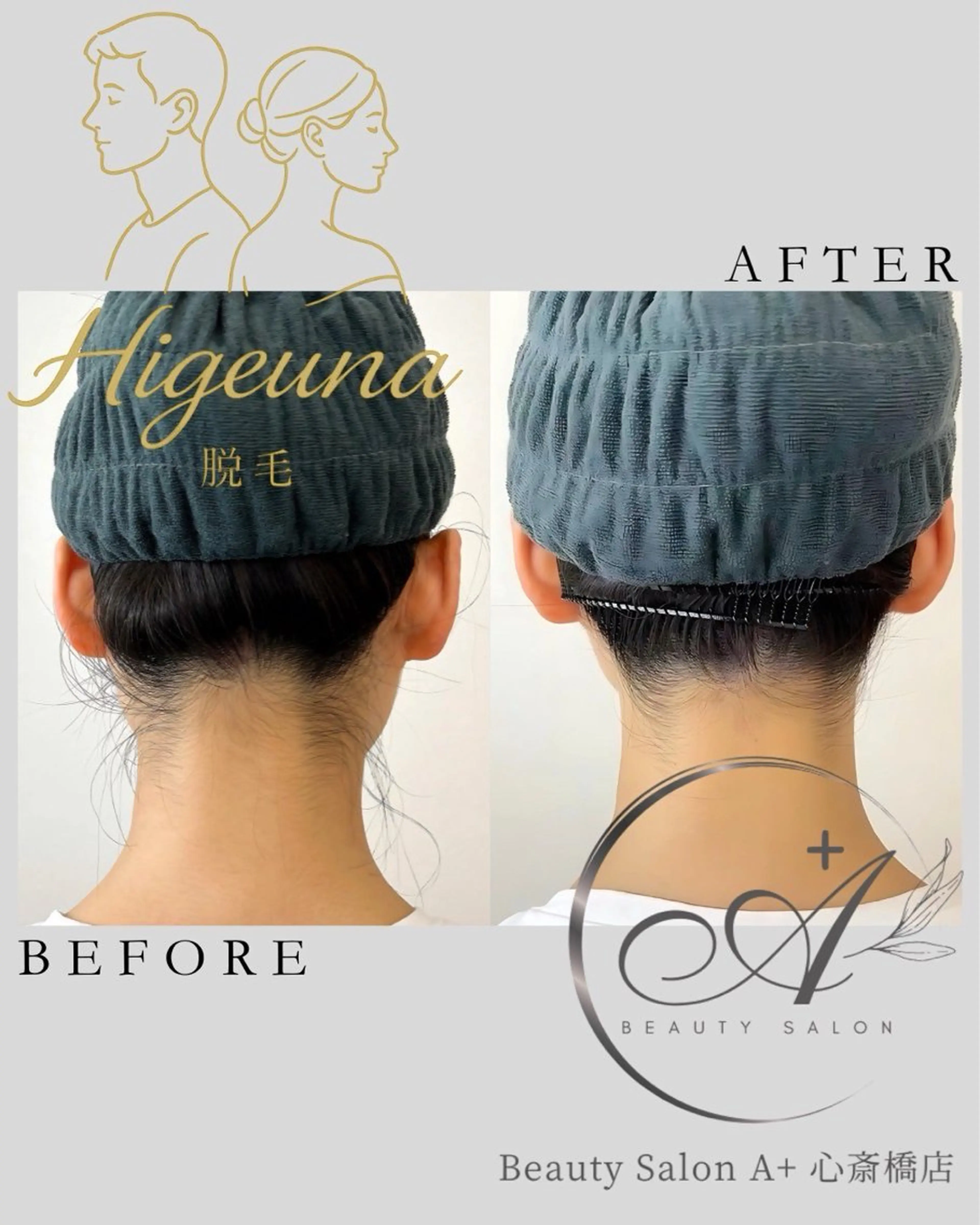 脱毛 うなじ脱毛/ つや肌ハーブのエステ・リラクイメージ