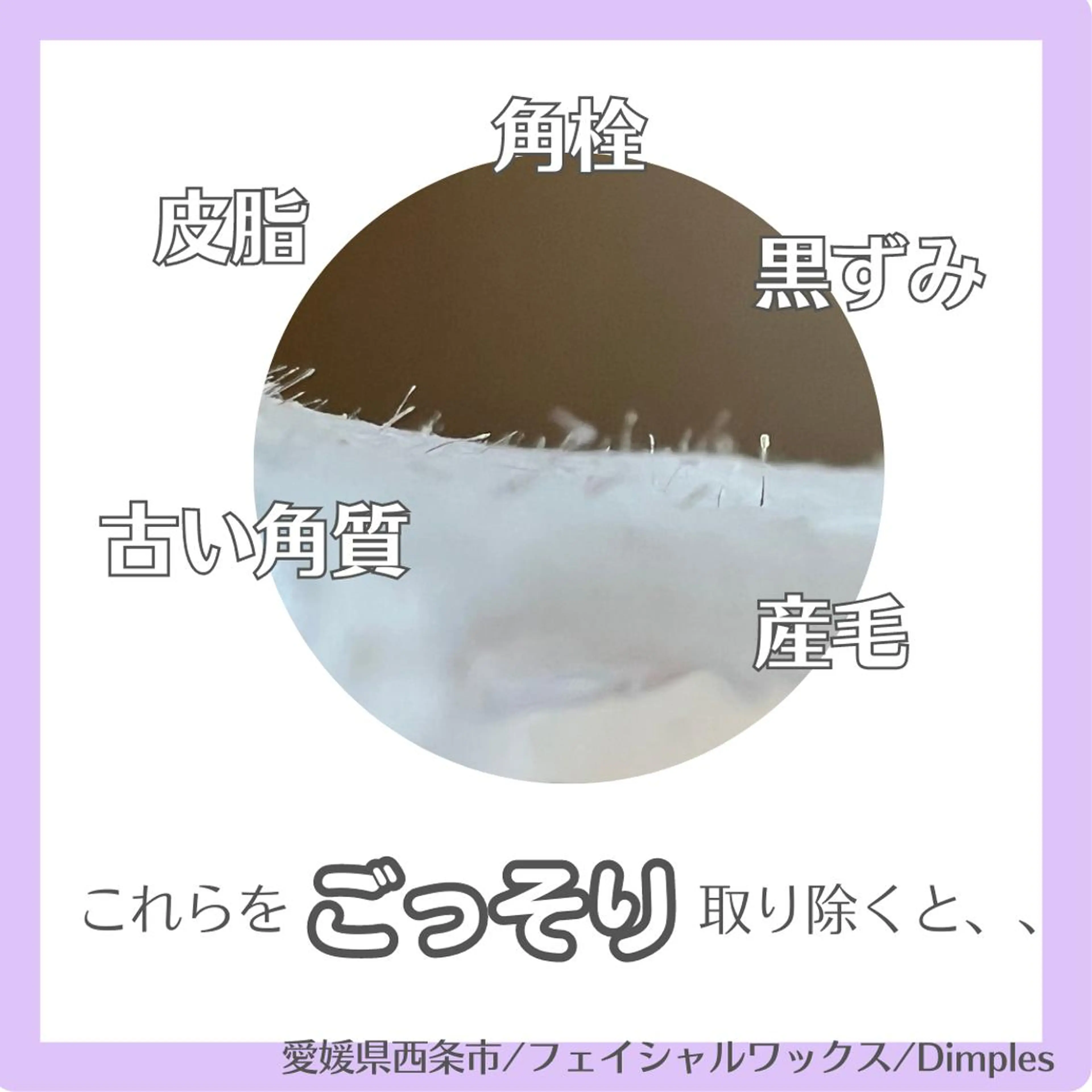 Dimples eyelashのエステ・リラクイメージ